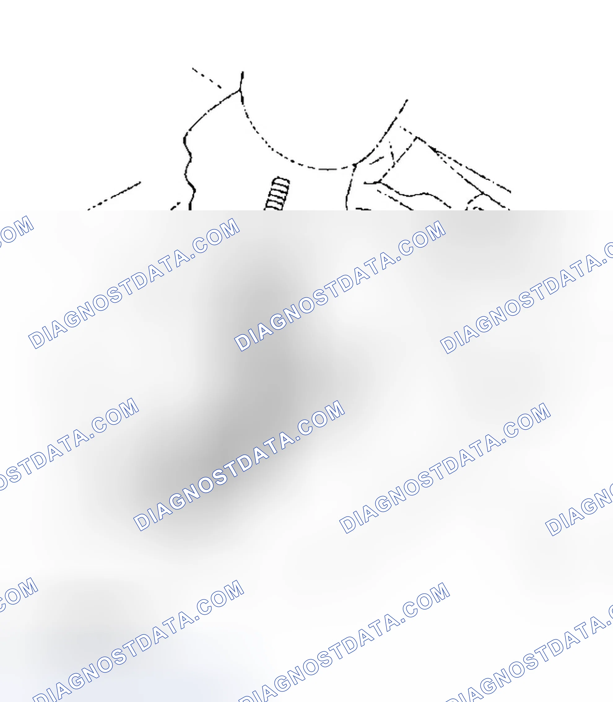 Scheme 57: REMOVAL