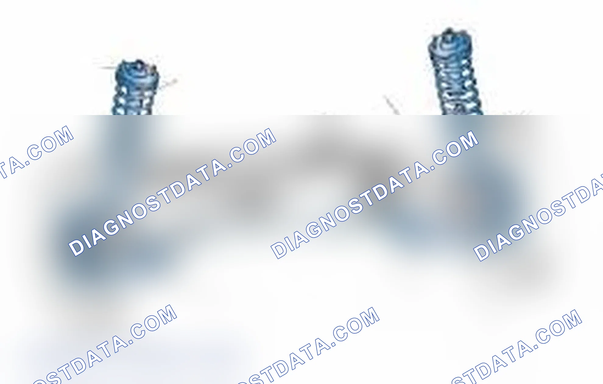 Scheme 25: Typical Front Suspension & Steering Components