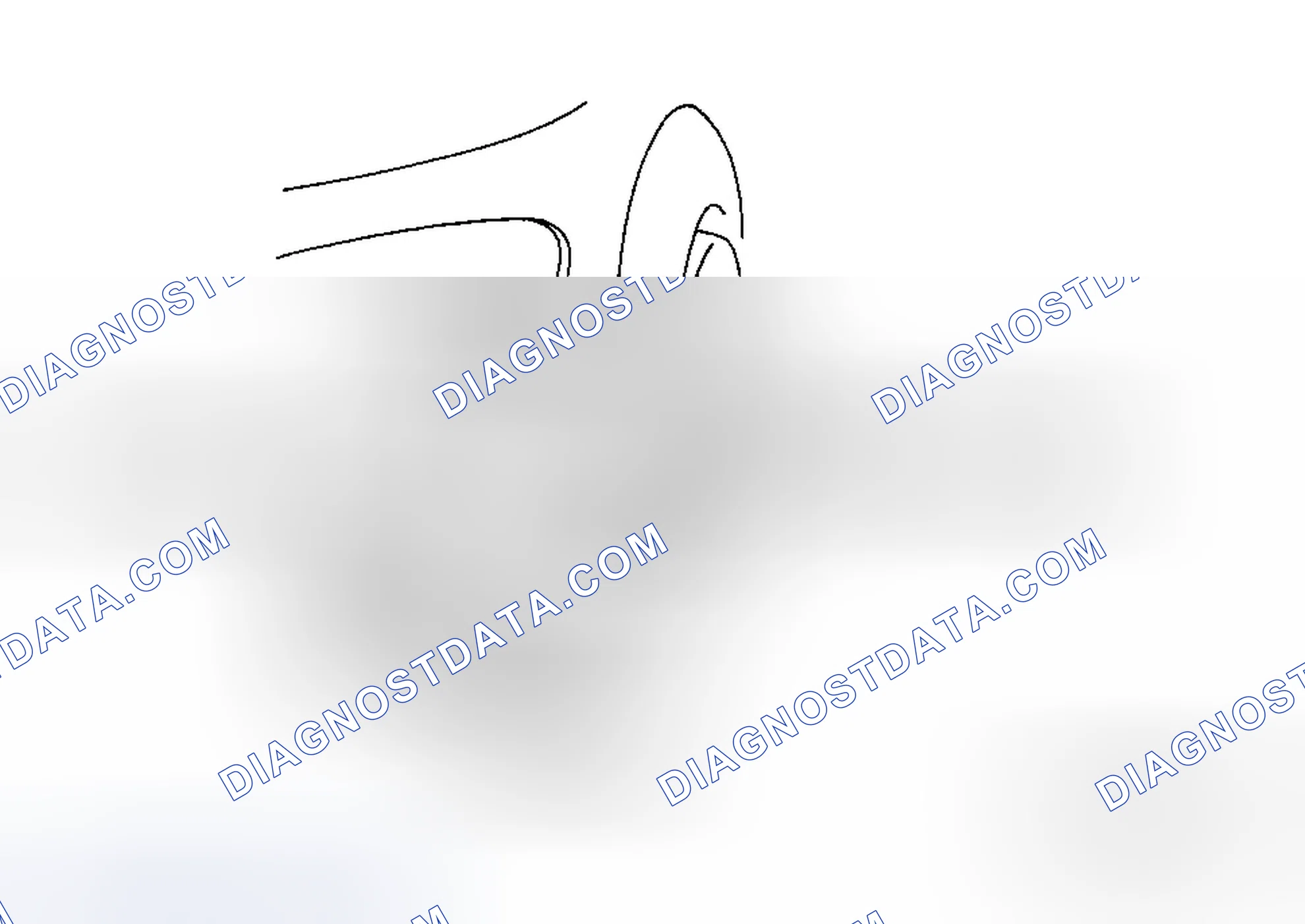 Scheme 46: FRONT FOG LIGHT REMOVAL/INSTALLATION