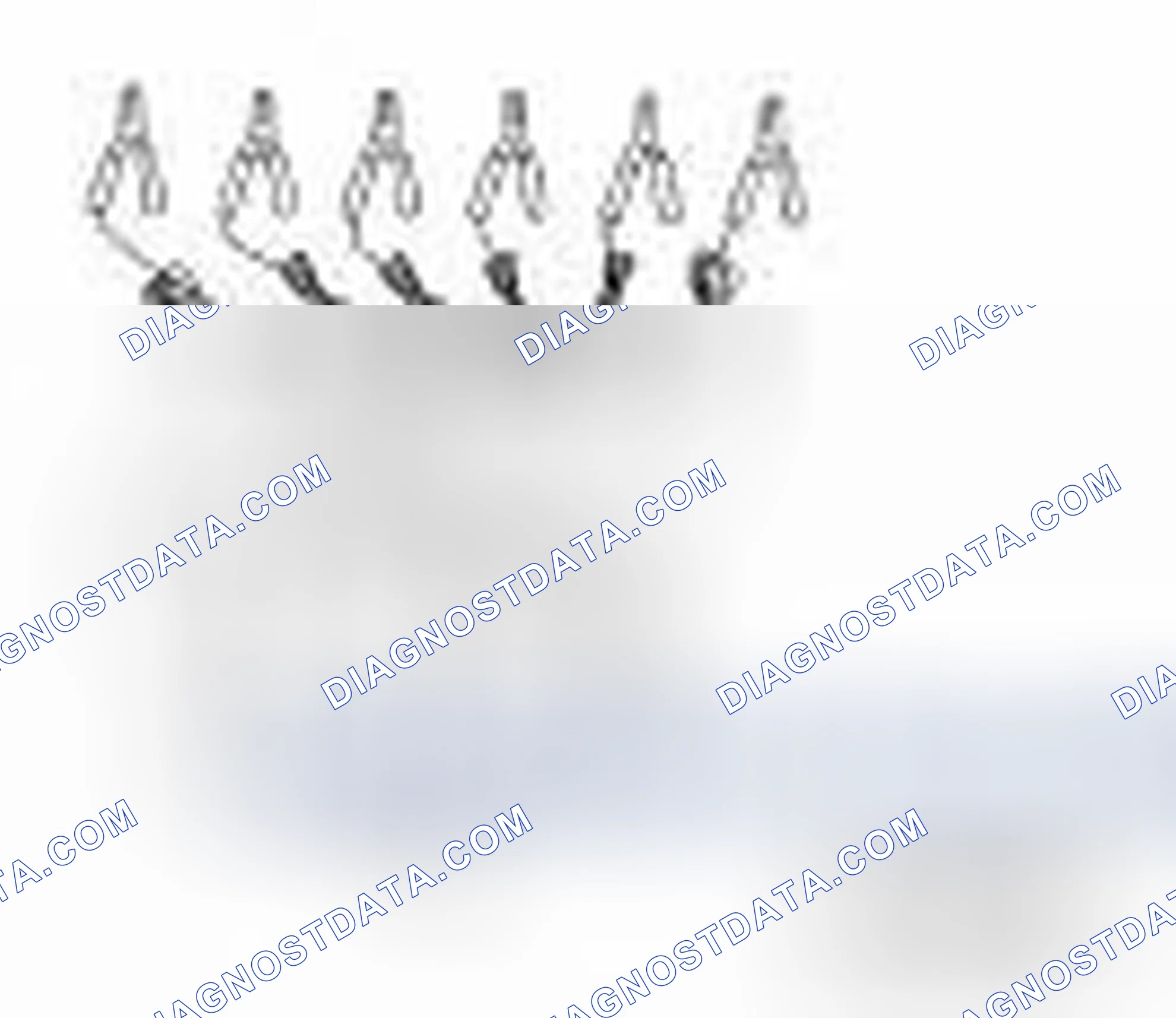 Scheme 152: Special Service Tool