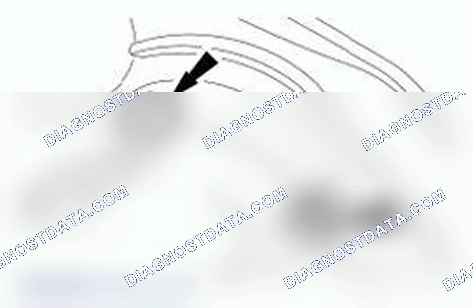 Scheme 105: Removal