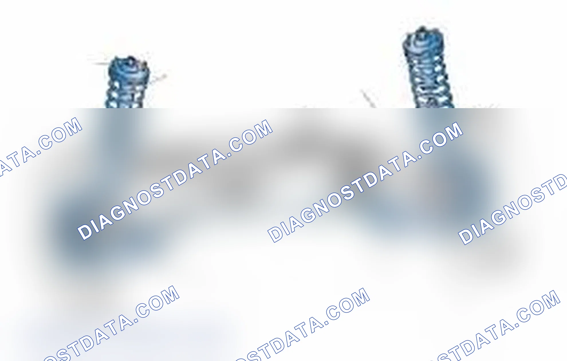 Scheme 25: Typical Front Suspension & Steering Components