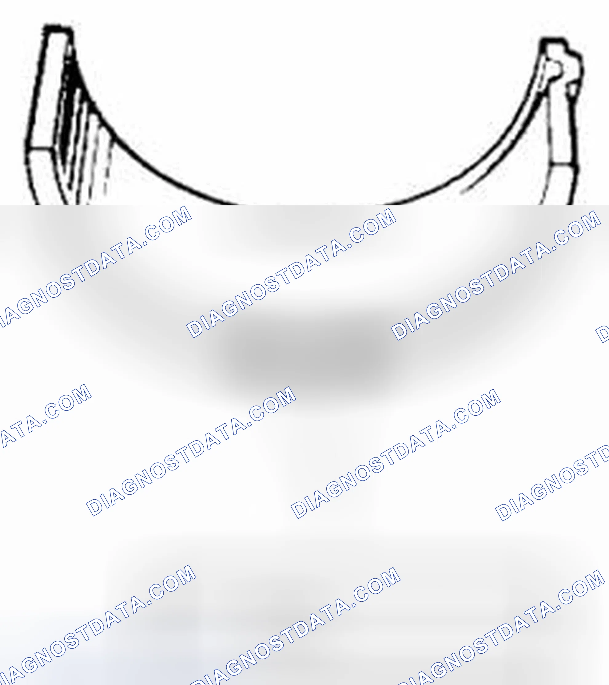 Scheme 209: Undersize bearing (0.25 mm)