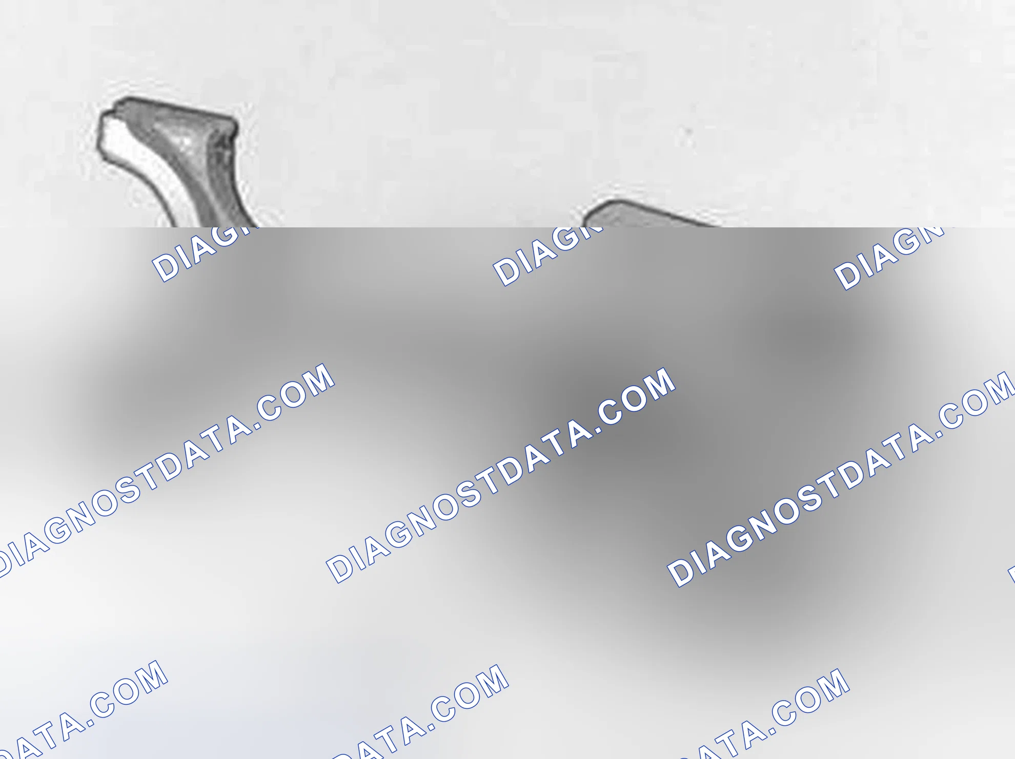 Scheme 424: Assembling pistons and connecting rods