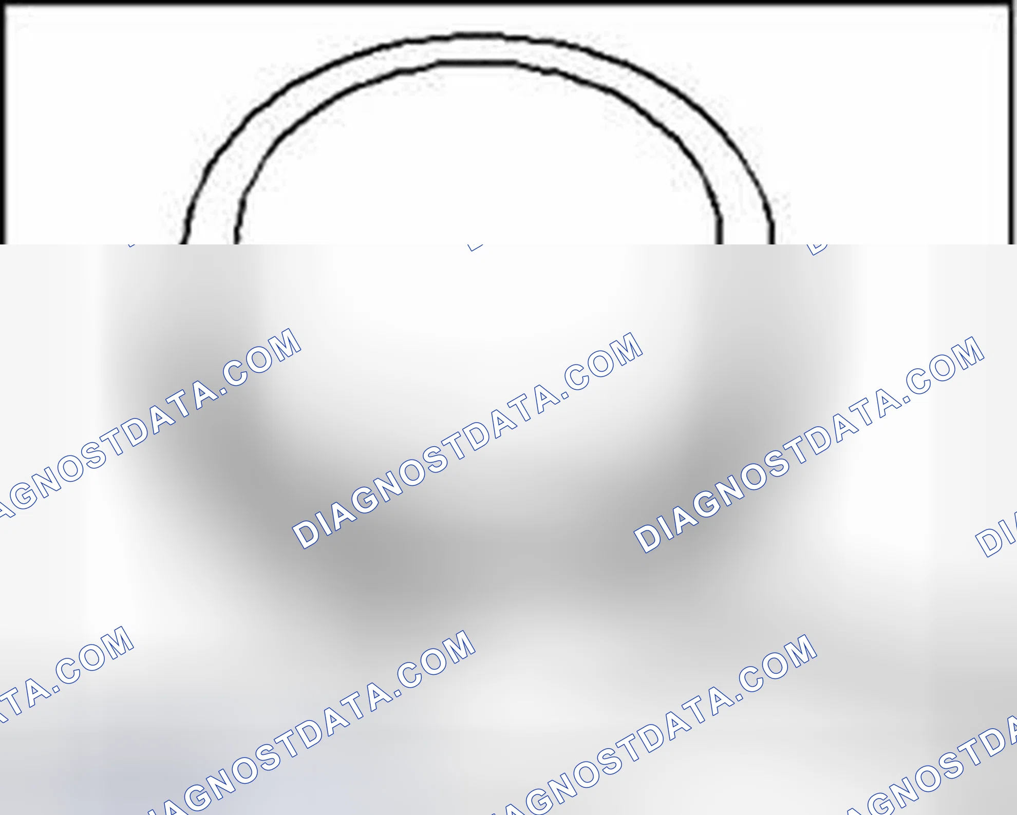 Scheme 17: Measuring piston ring side clearance