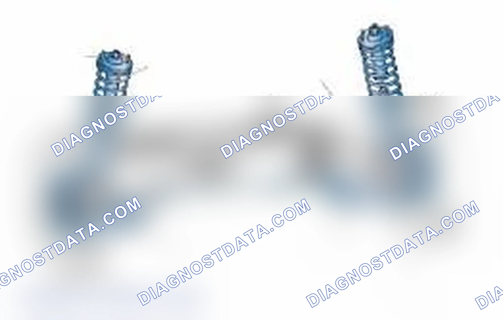 Scheme 25: Typical Front Suspension & Steering Components