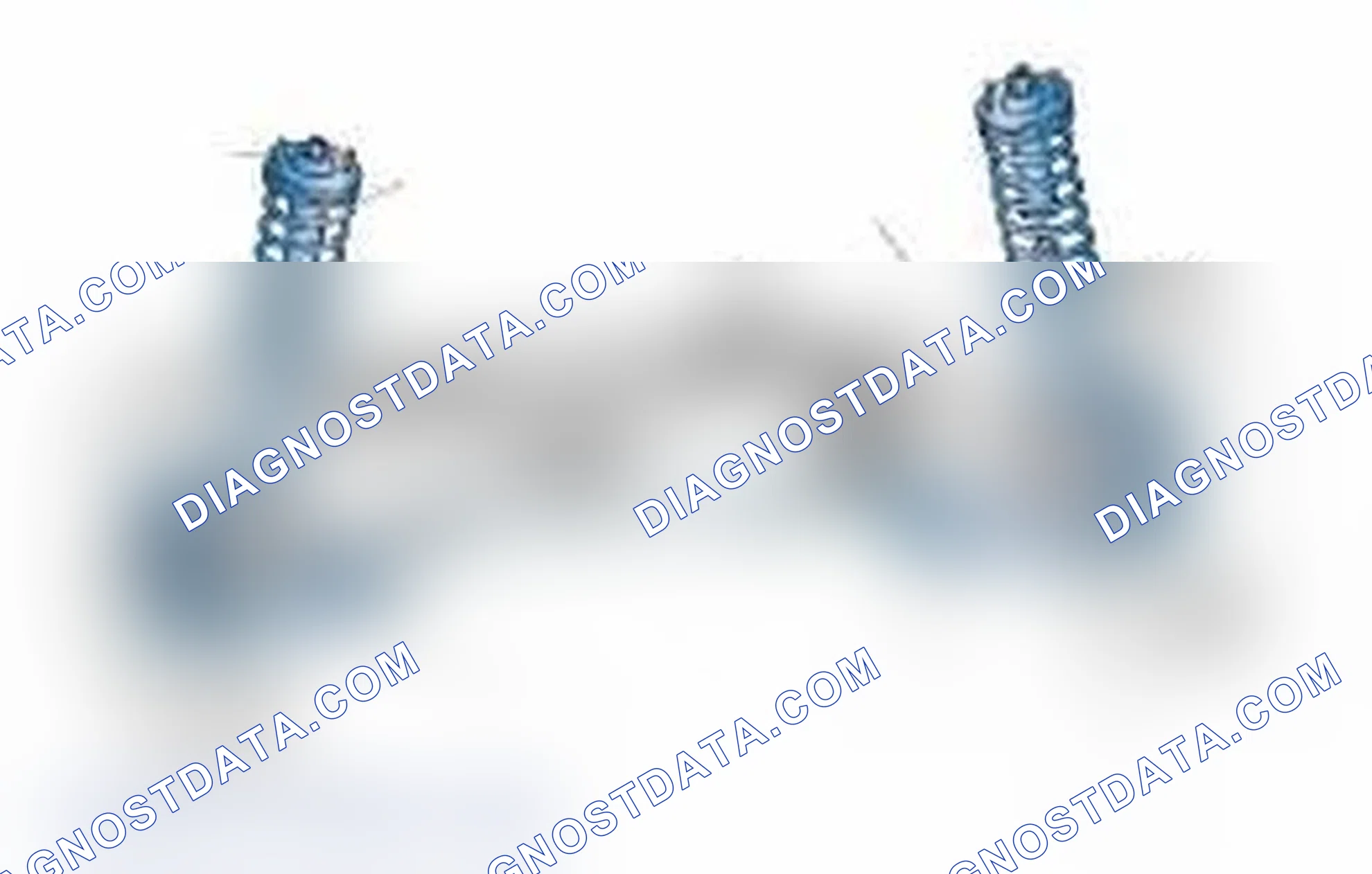 Scheme 25: Typical Front Suspension & Steering Components