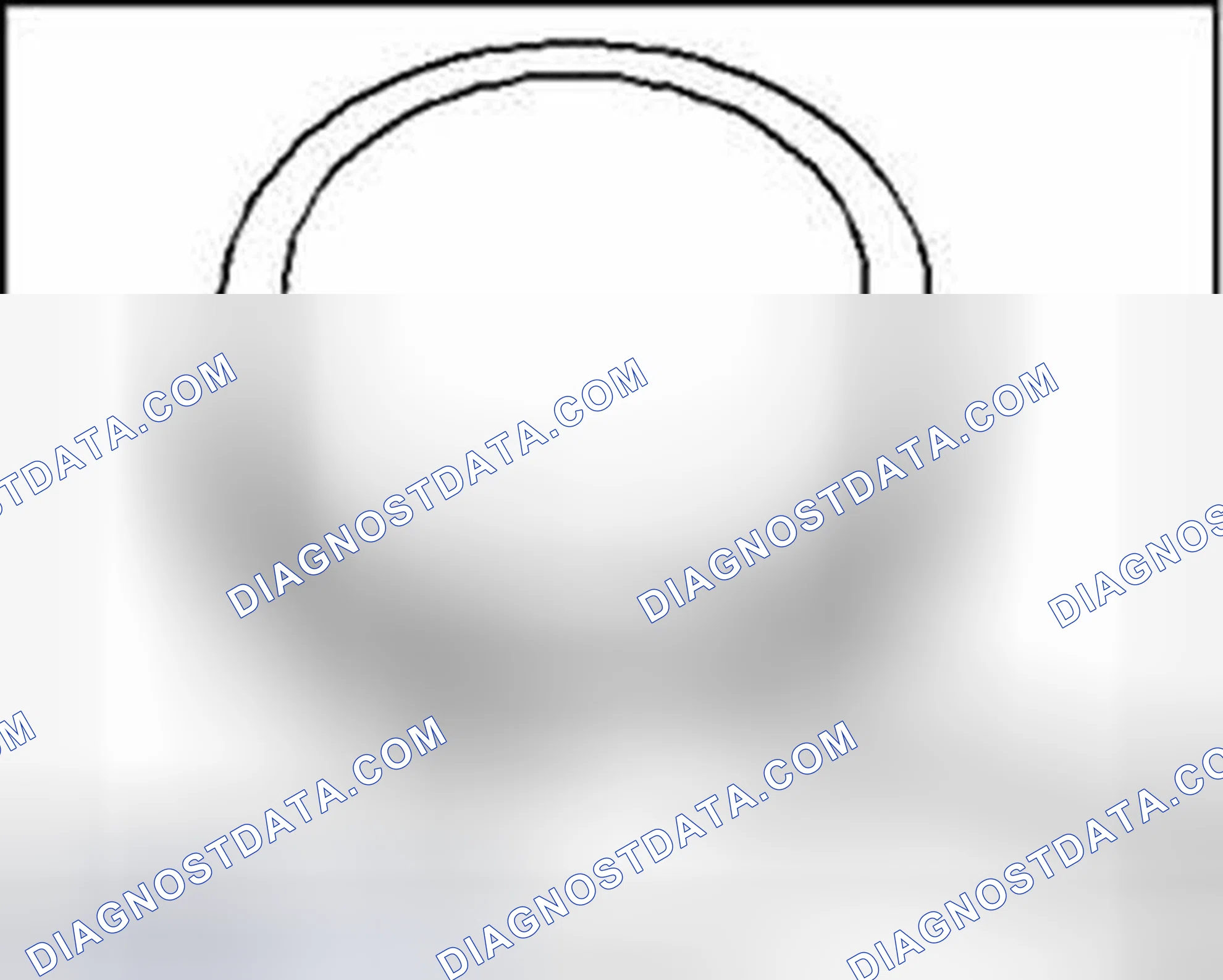 Scheme 44: Checking ring to groove clearance