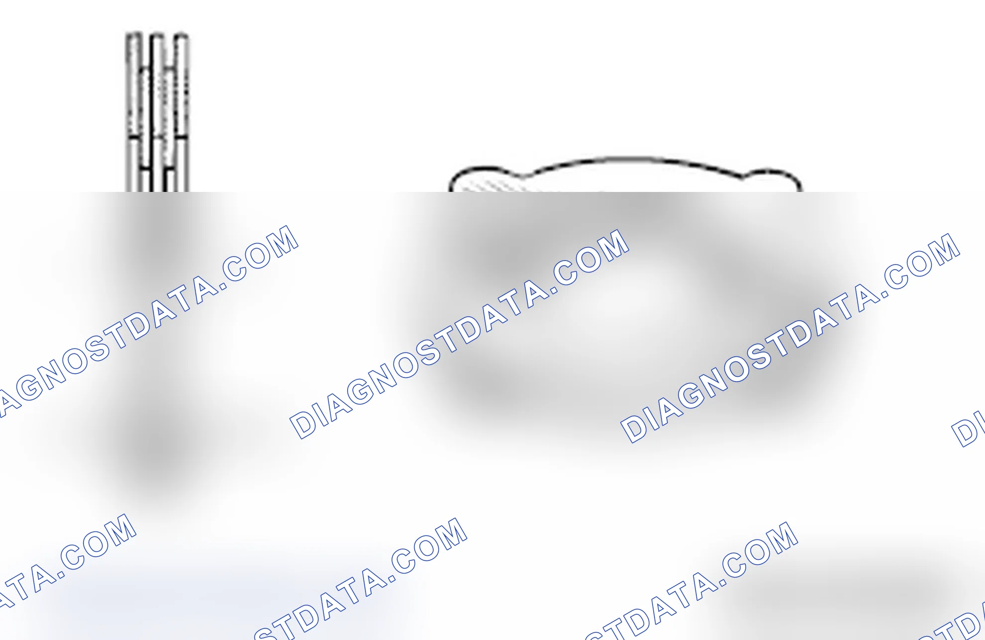 Scheme 99: >> A << DIFFERENTIAL CASE B INSTALLATION