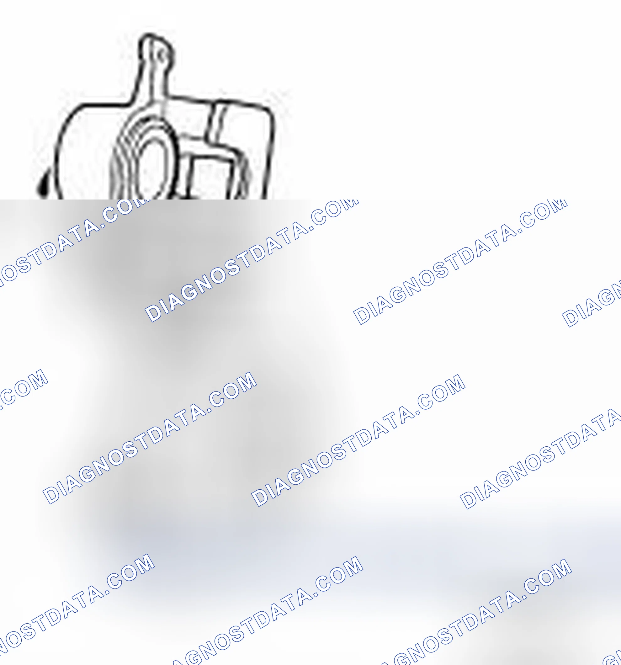 Scheme 24: DISC BRAKE : Inspection
