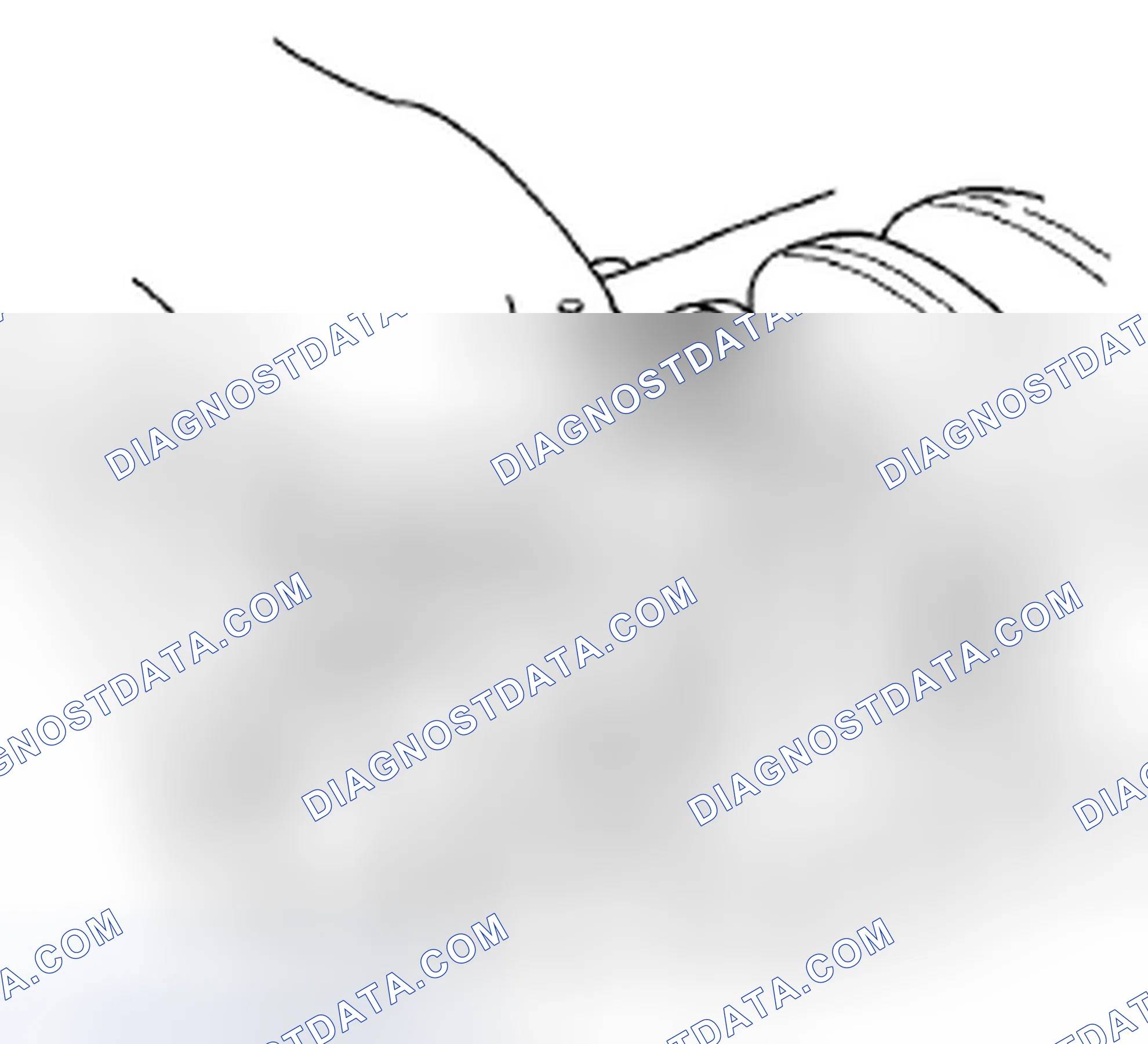 Scheme 248: Rod Bearing Clearance Inspection