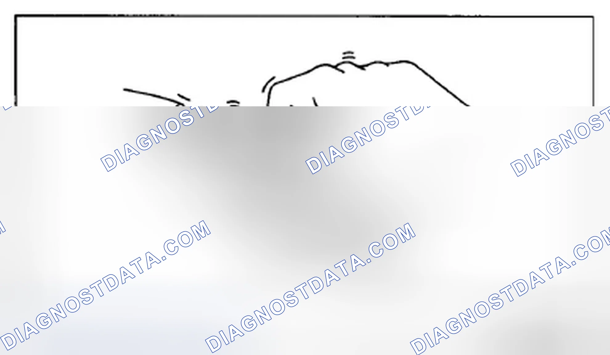 Scheme 108: Action for Non-repeatable Malfunction
