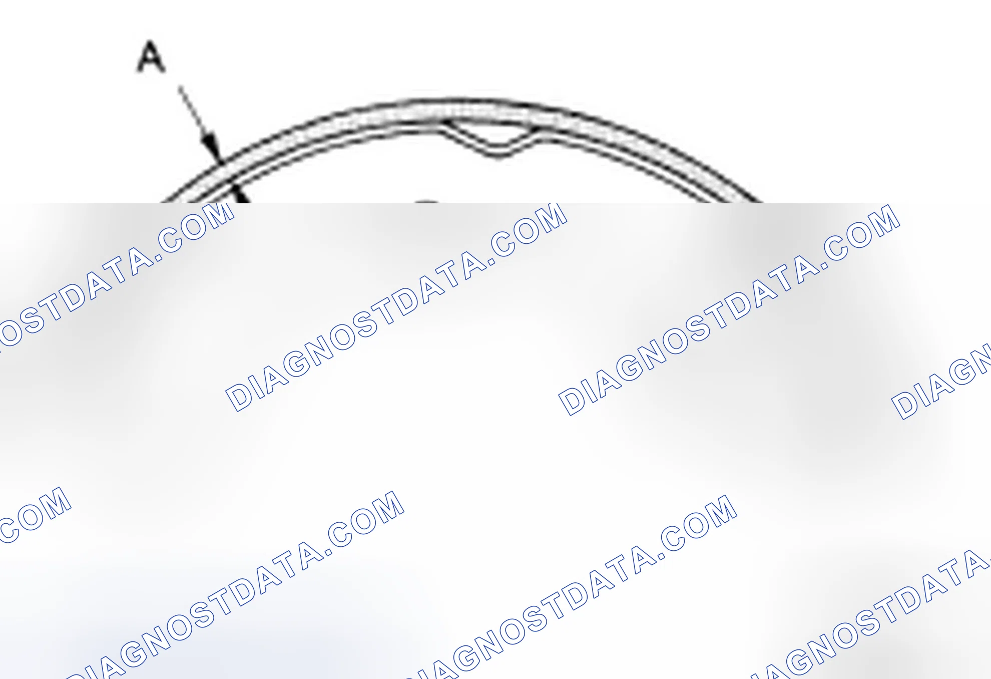 Scheme 52: Checking Lining Thickness