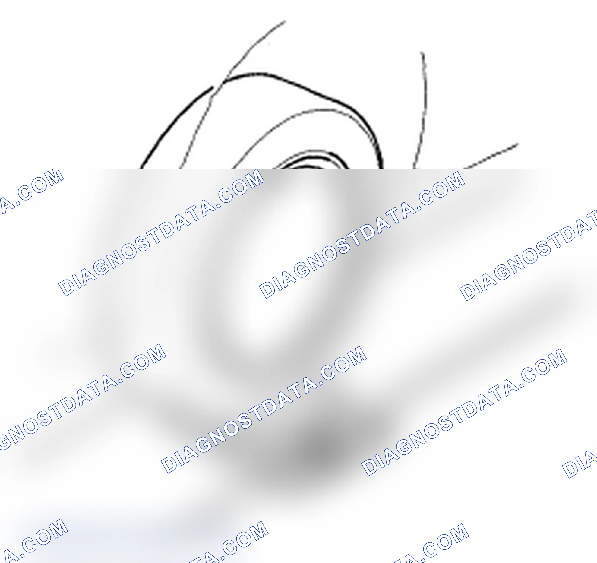 Scheme 10: Turning Angle Inspection