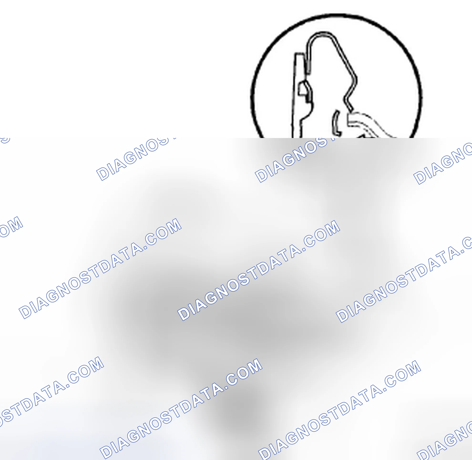 Scheme 11: REMOVAL