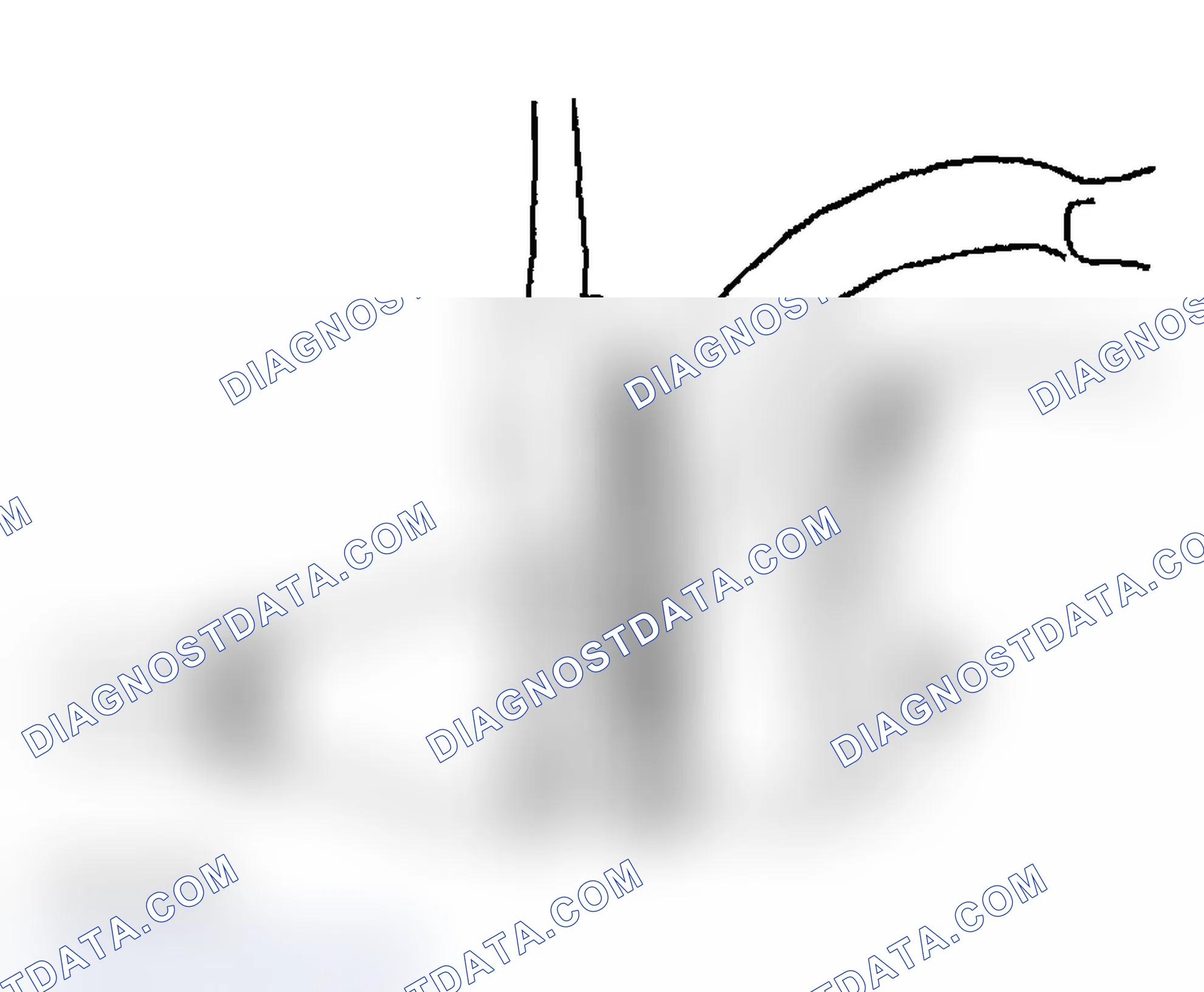 Scheme 6: Removal Procedure