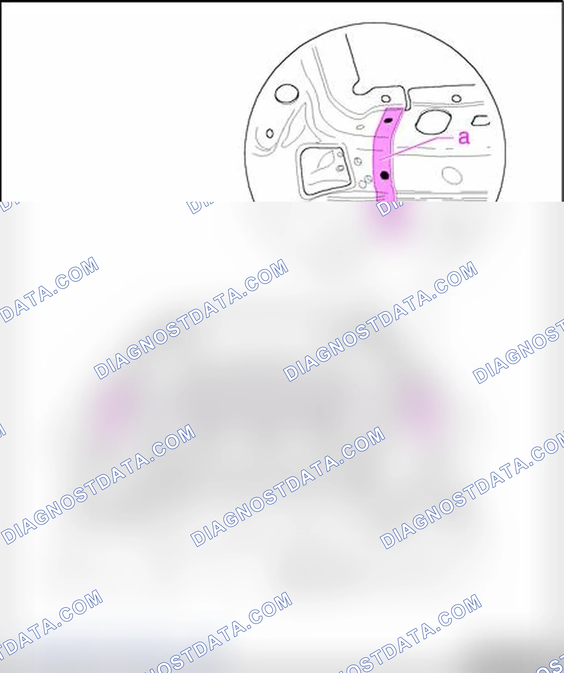 Scheme 84: Cutting locations