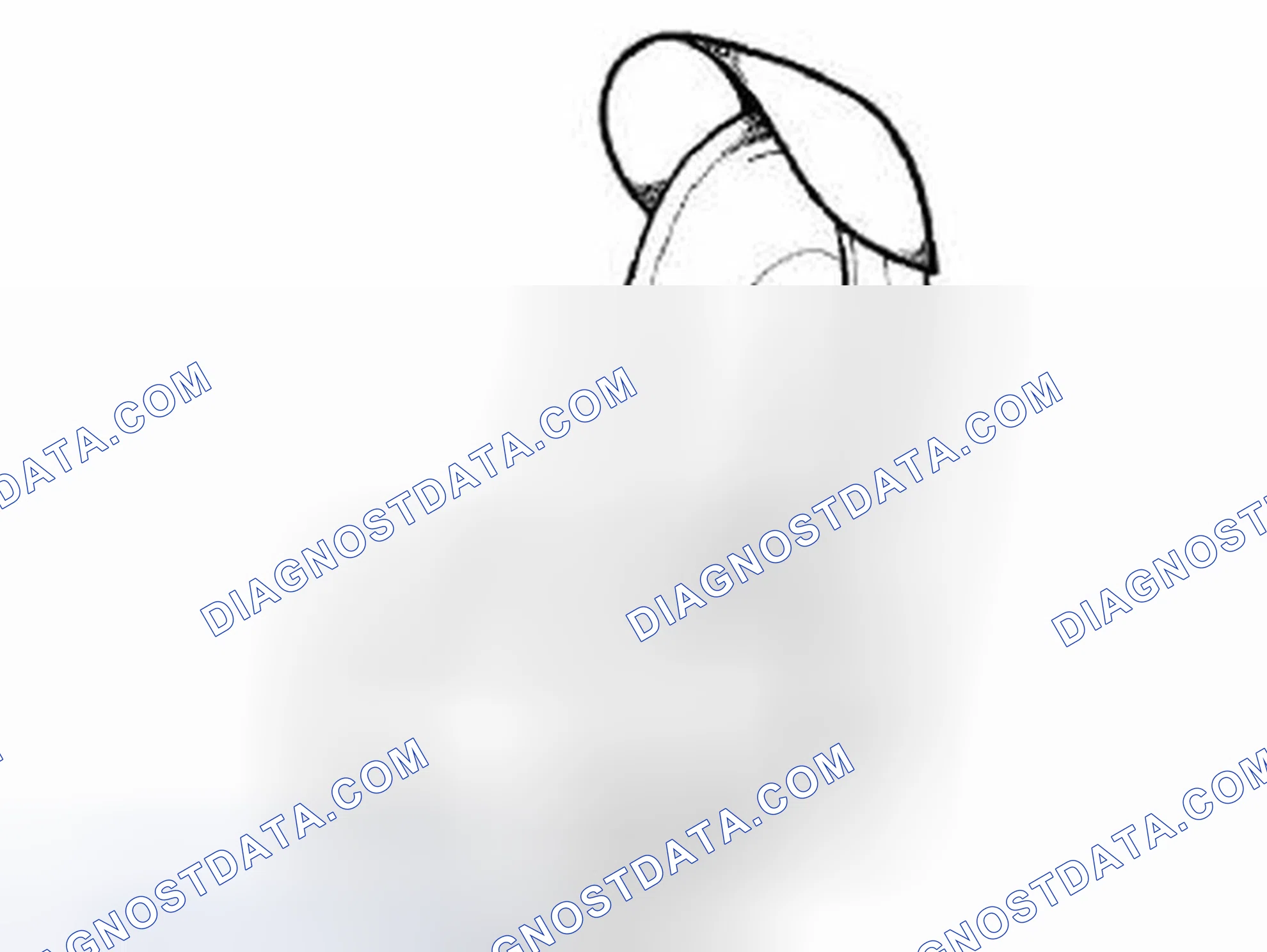 Scheme 83: SUN VISOR