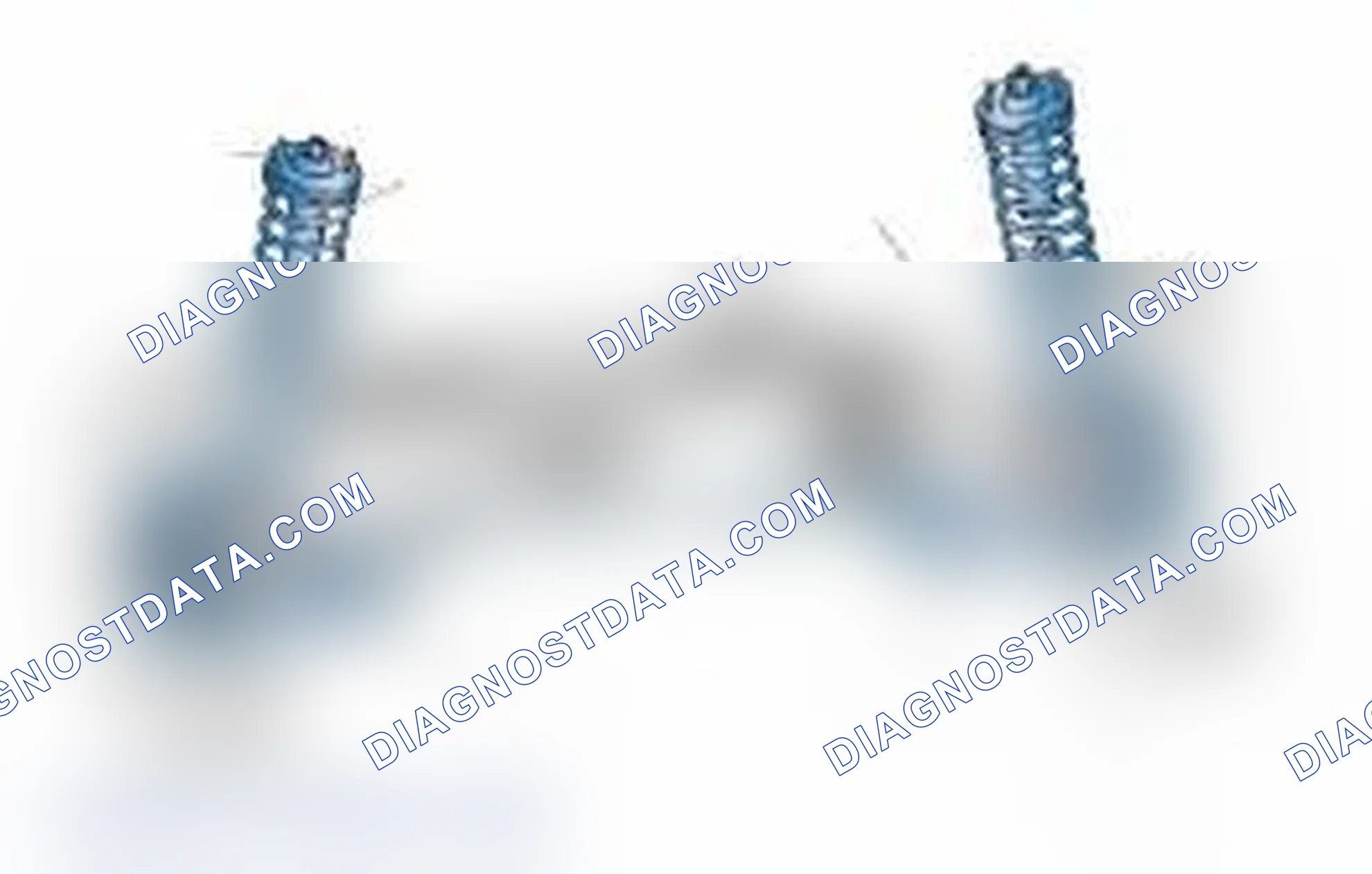Scheme 25: Typical Front Suspension & Steering Components
