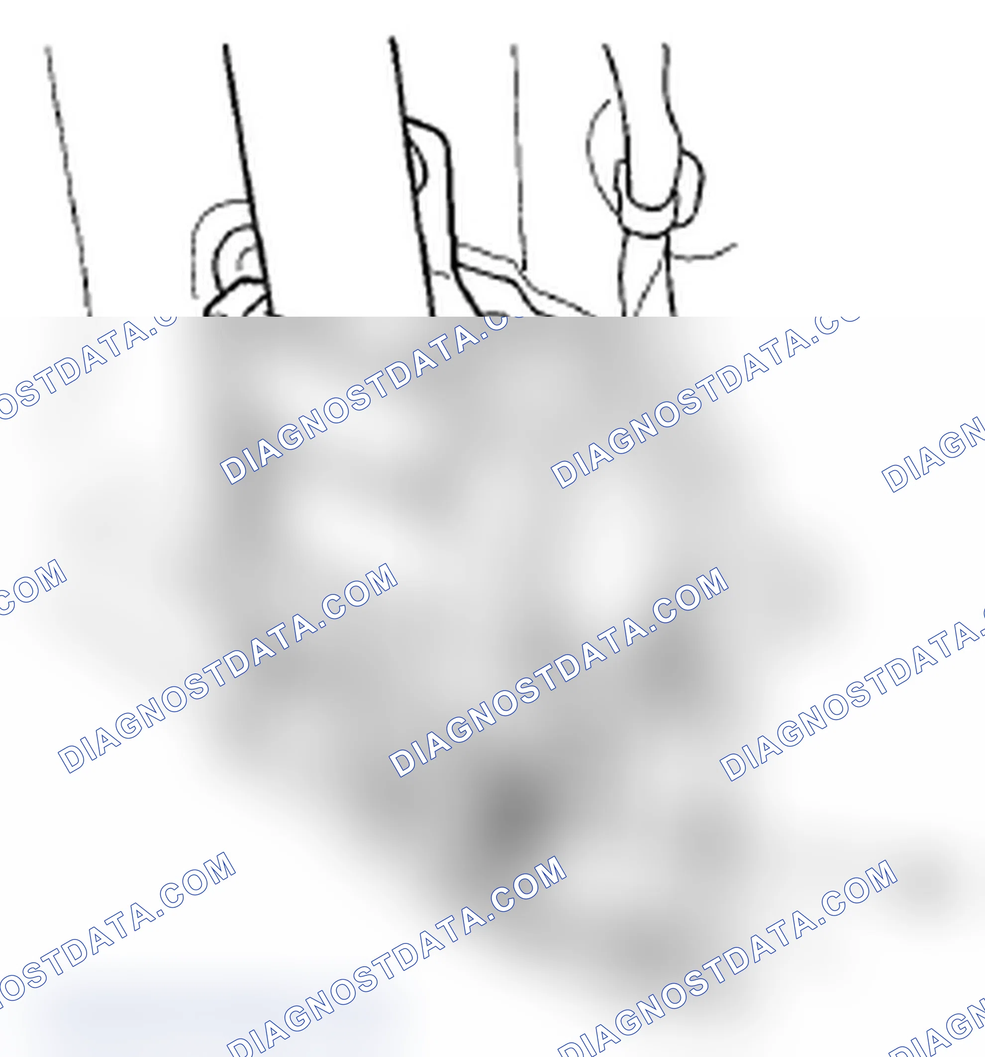 Scheme 207: Seat Belt Tensioner