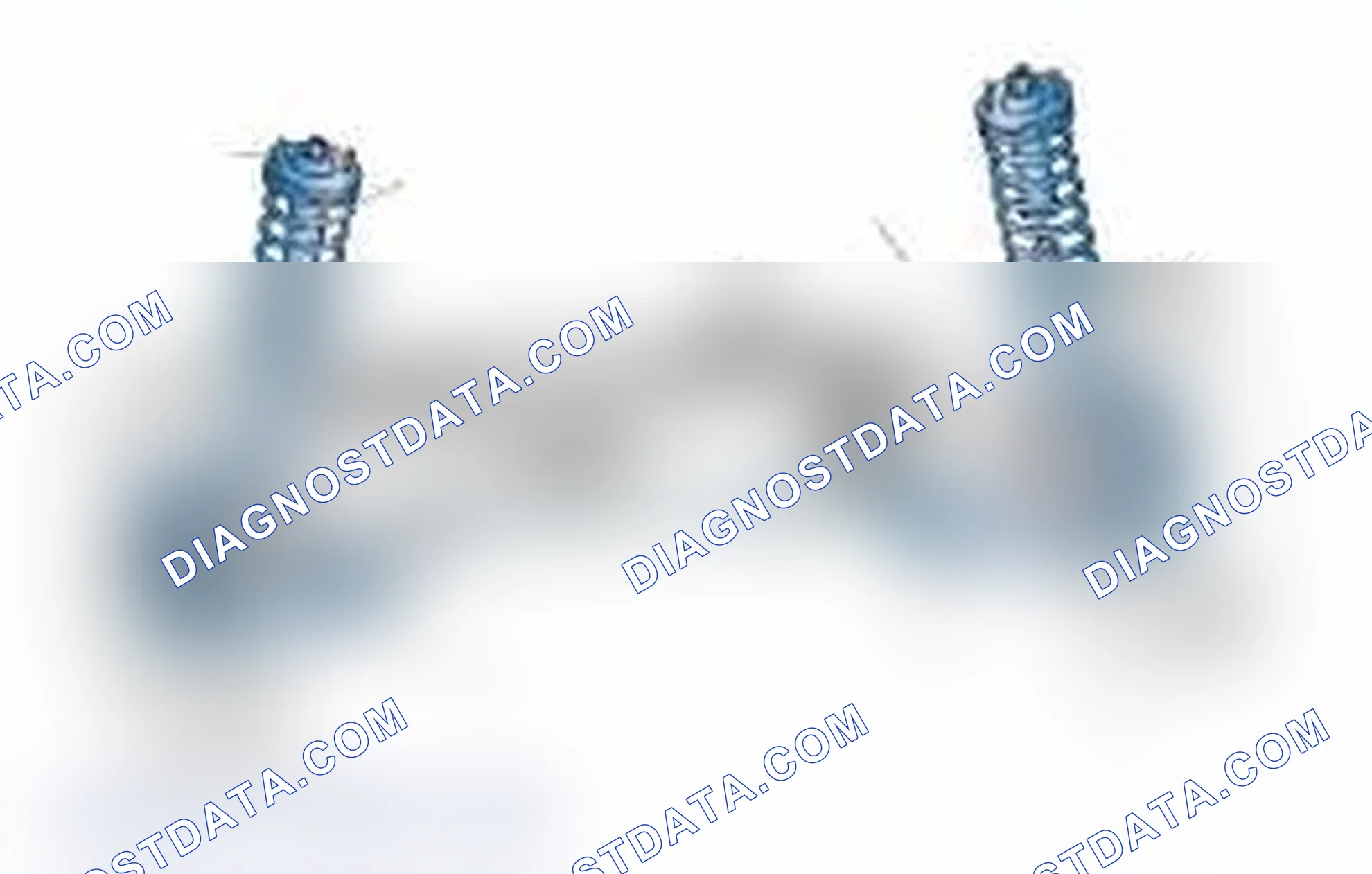 Scheme 25: Typical Front Suspension & Steering Components