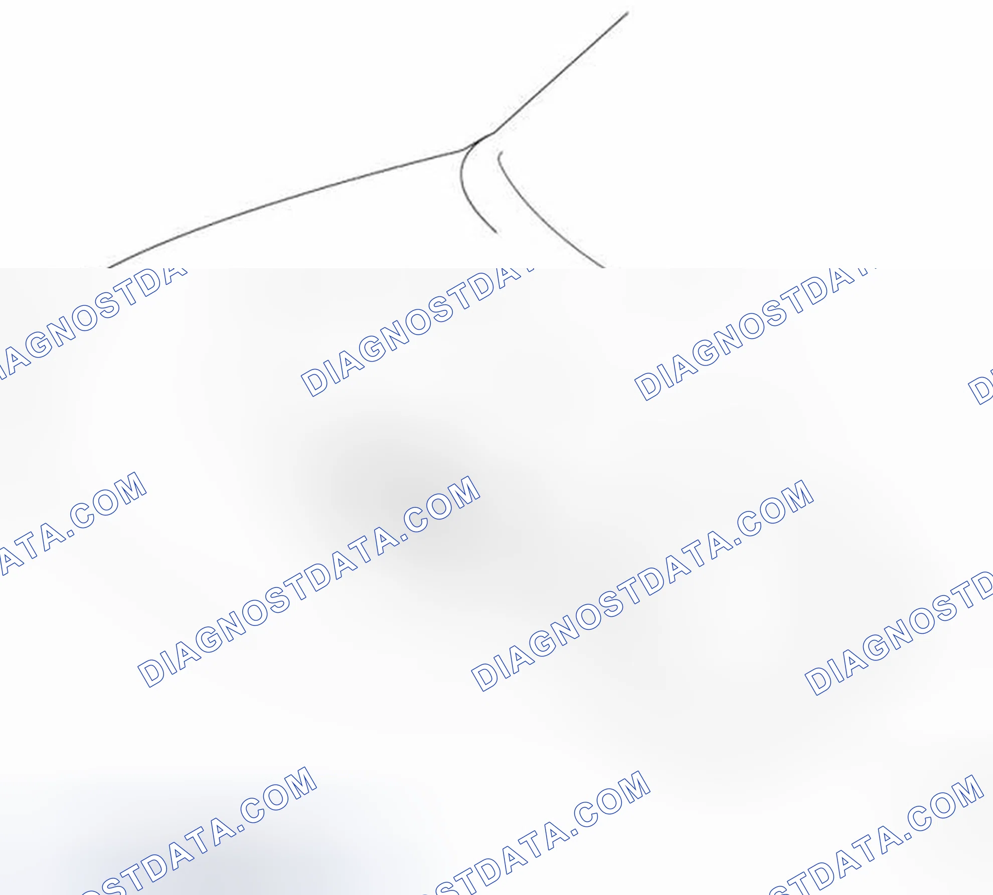 Scheme 30: Engine Mounting