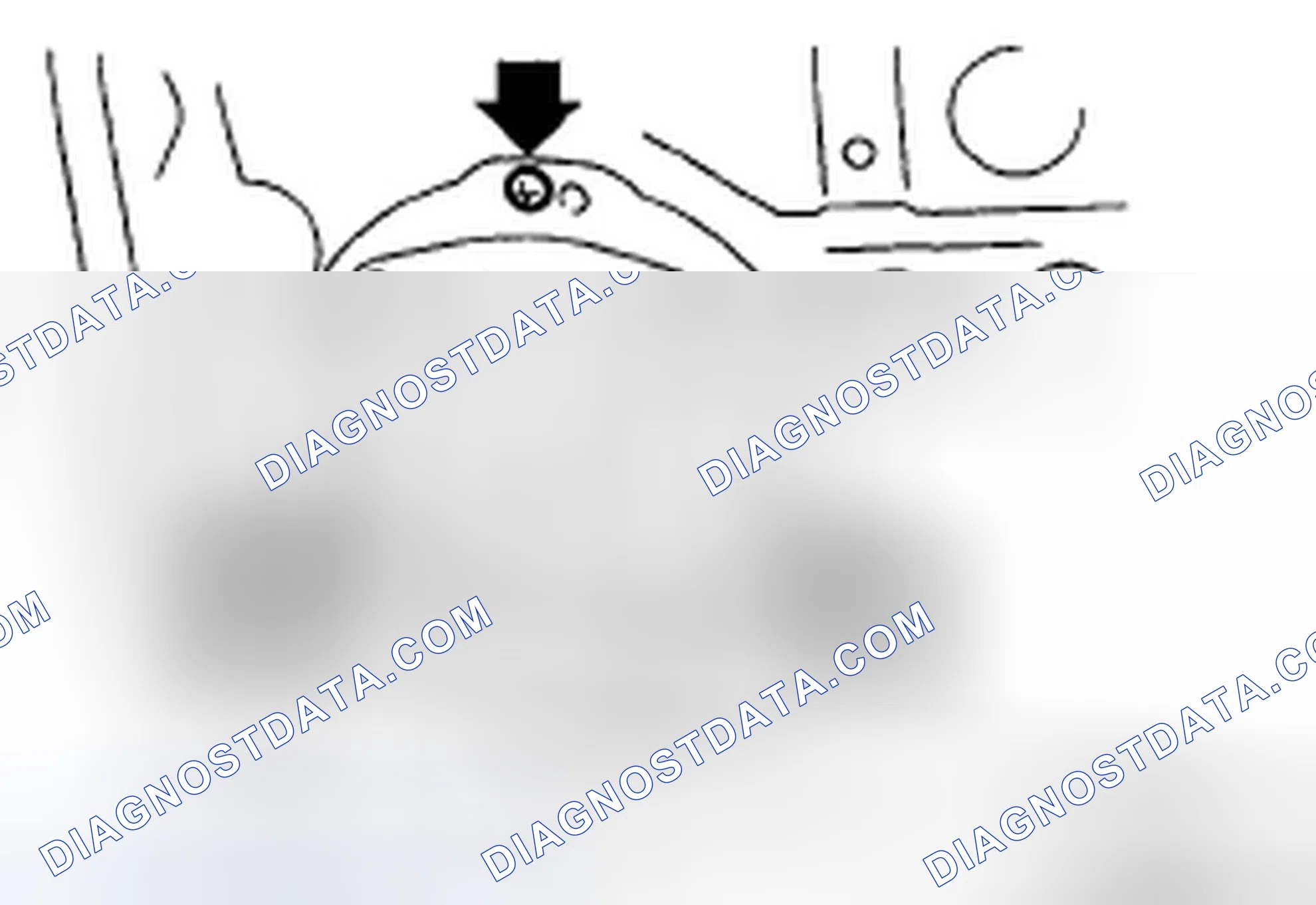 Scheme 10: REMOVAL