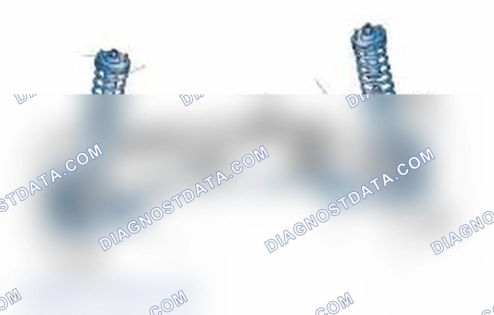Scheme 25: Typical Front Suspension & Steering Components