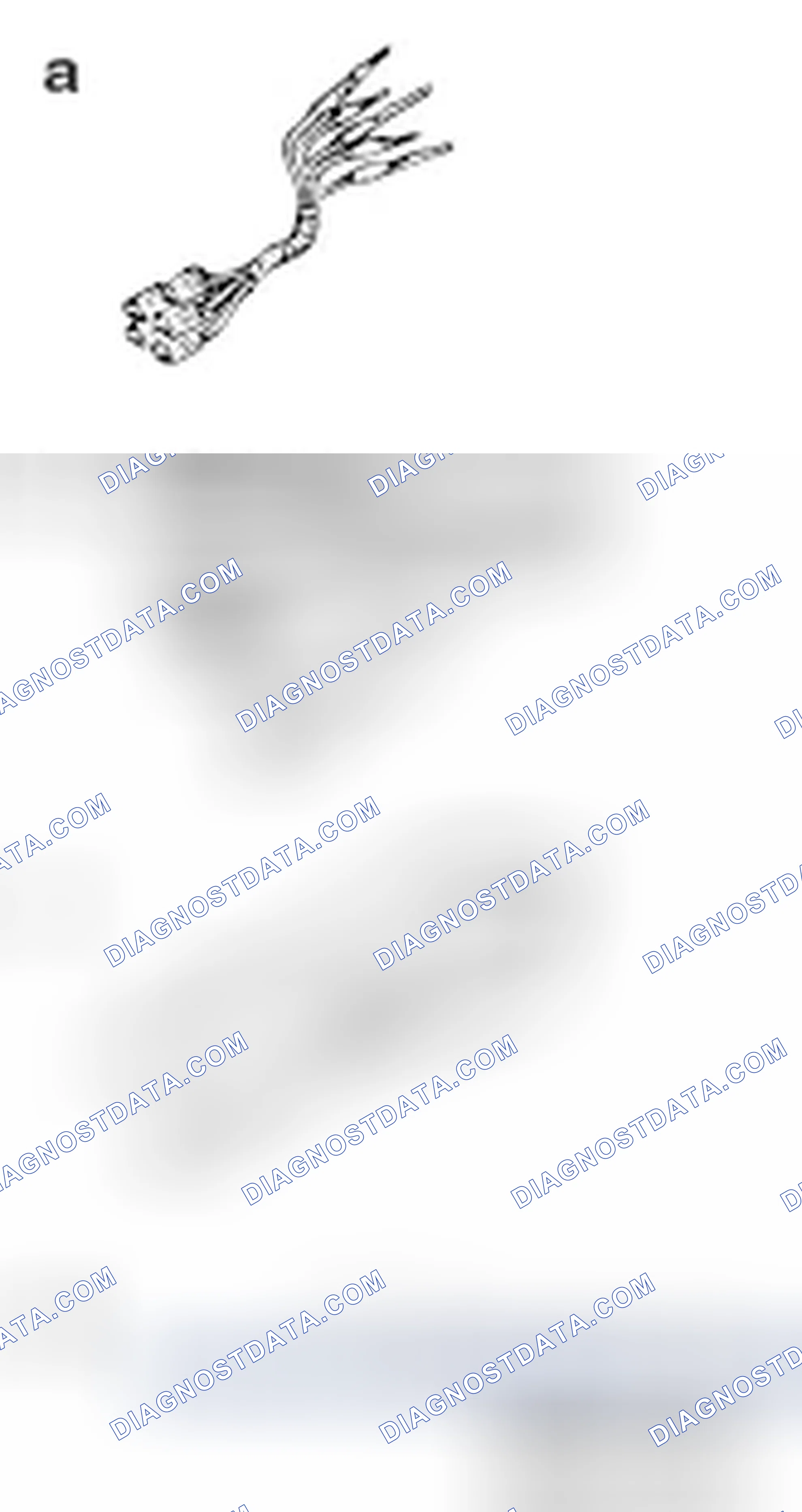 Scheme 371