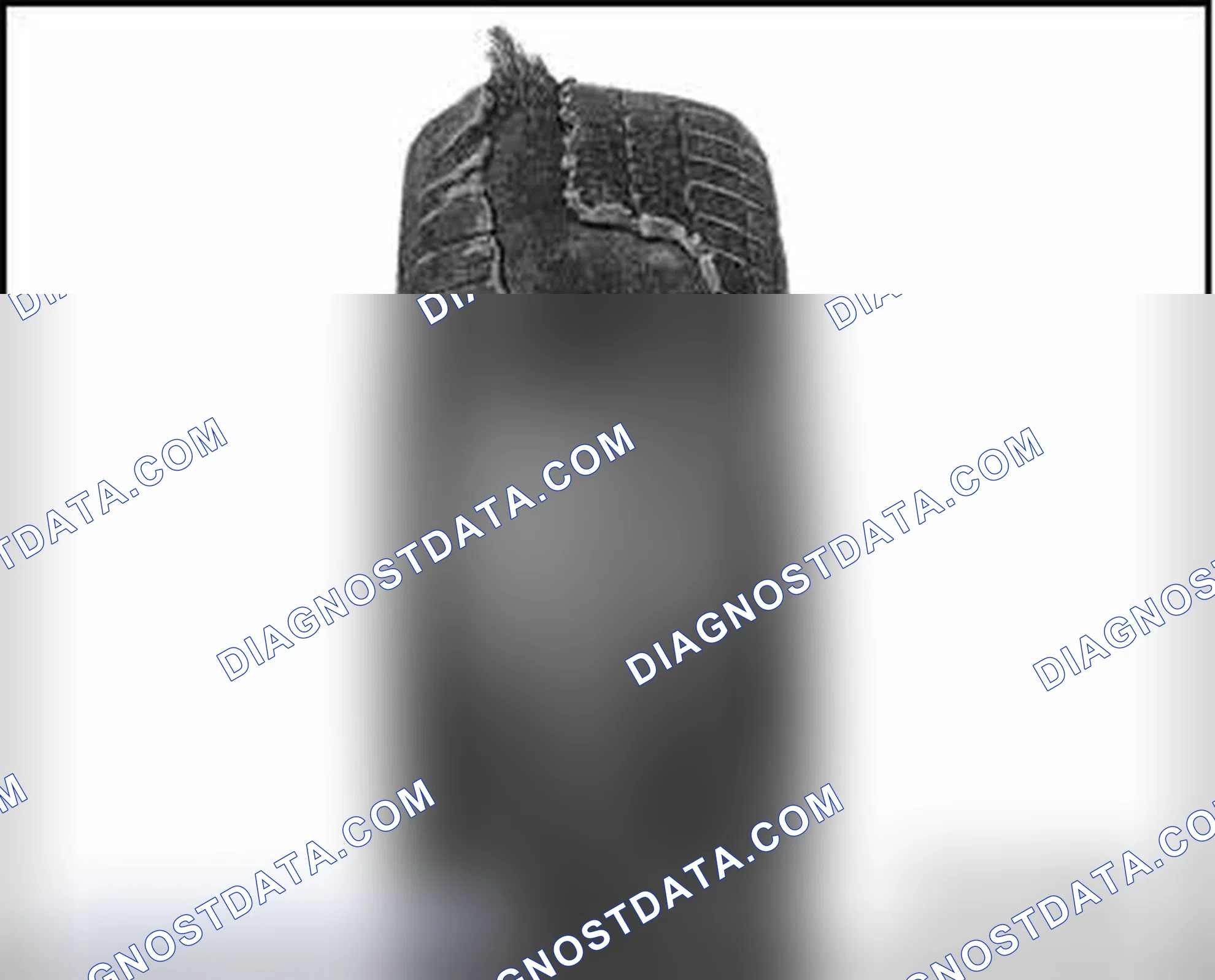Scheme 27: DISINTEGRATED TREAD