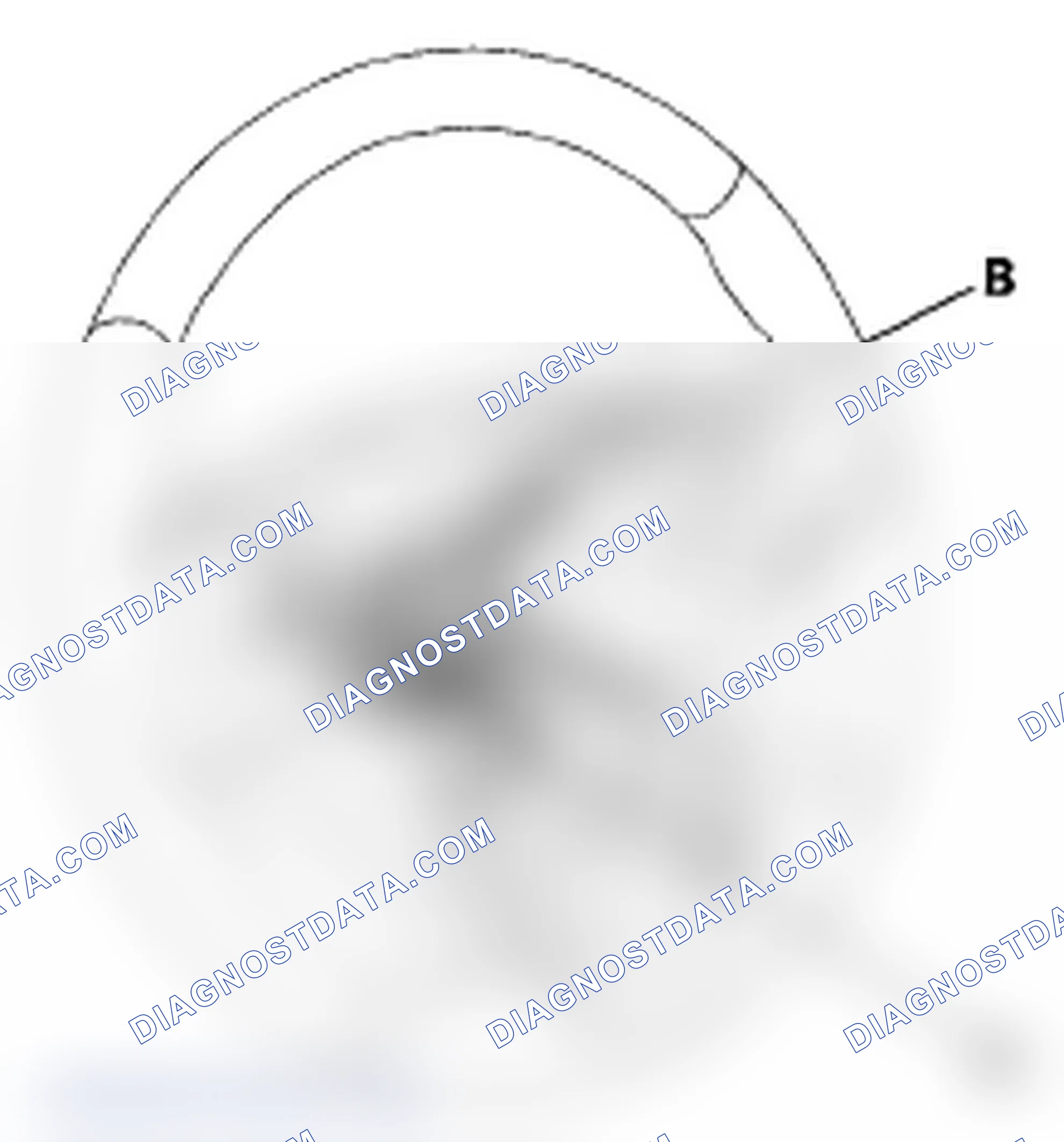 Scheme 33: Steering Wheel Removal