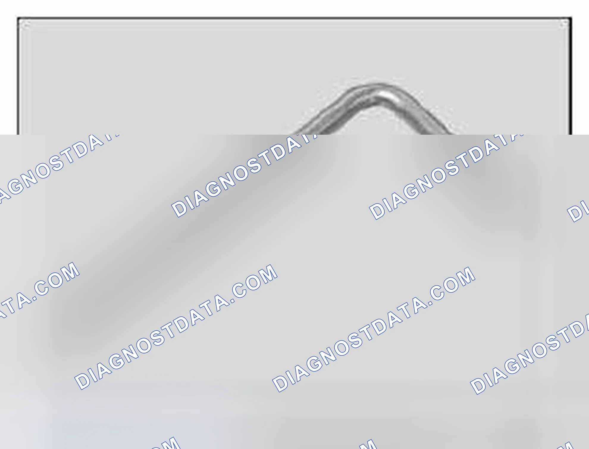 Scheme 381: 11 0 390 Clamping pin