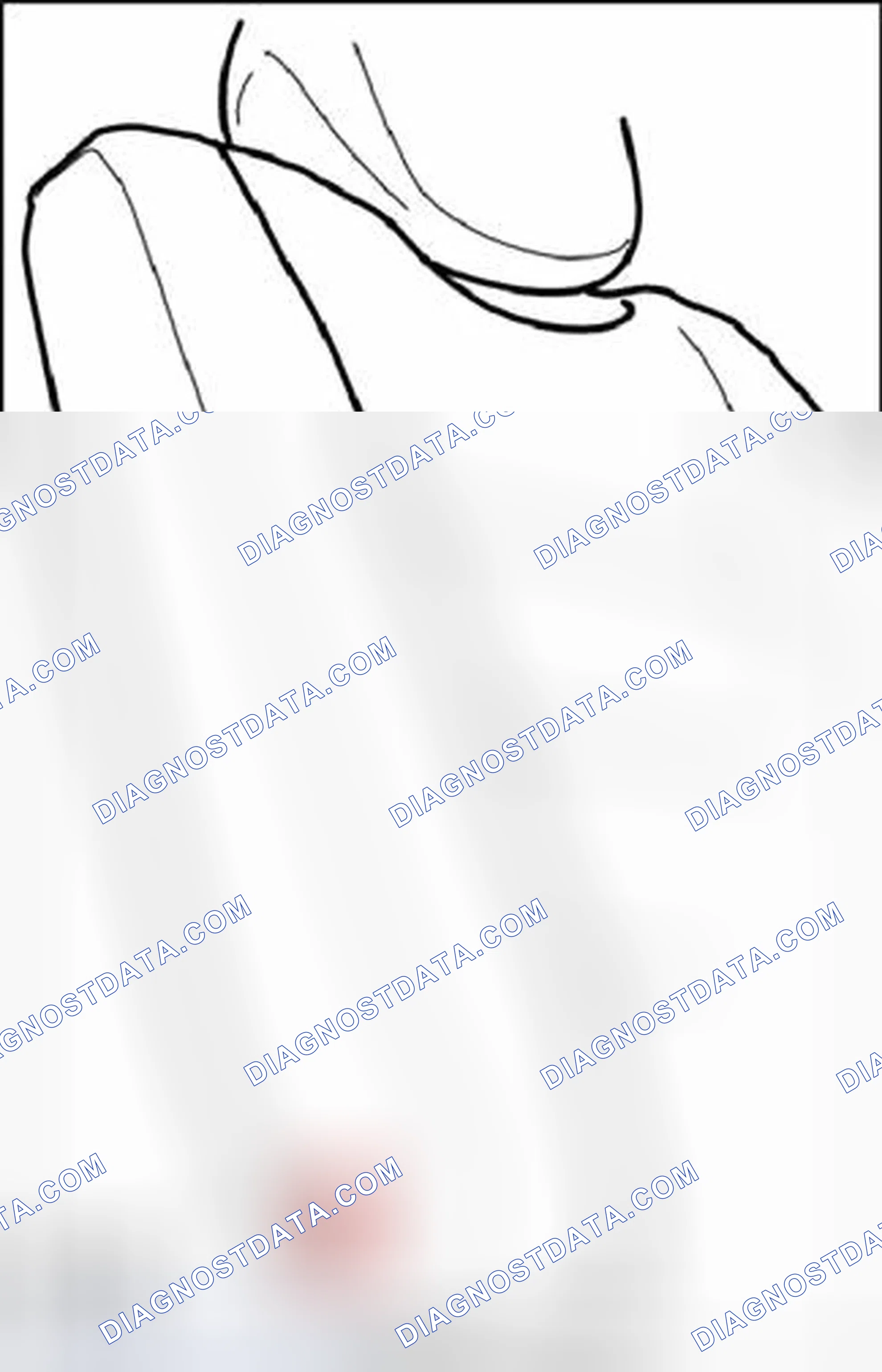 Scheme 120: Removing bushing for center bearing