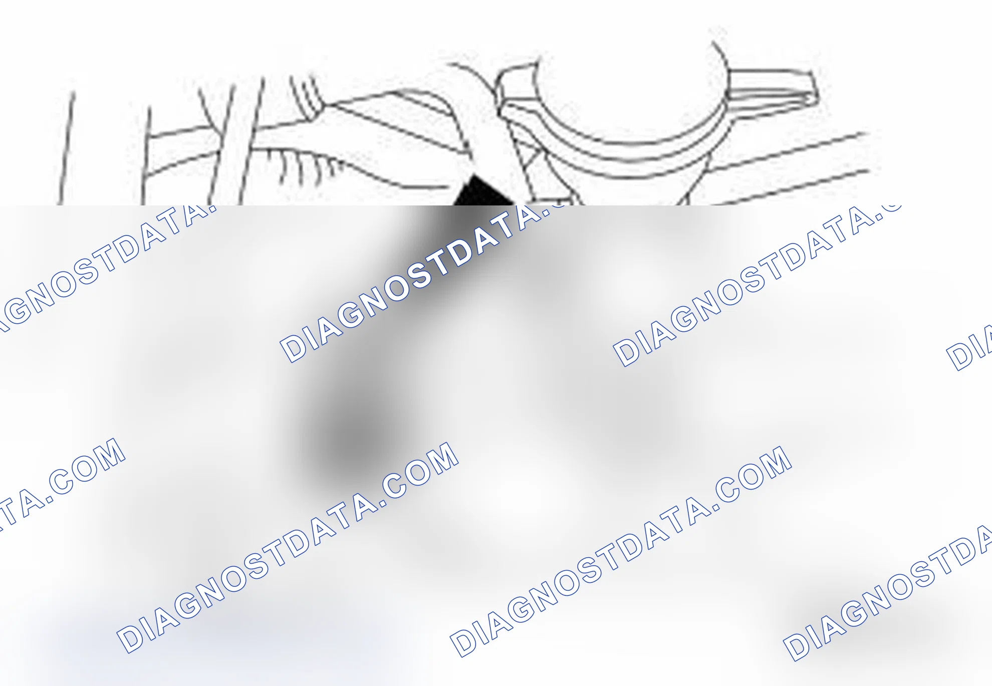 Scheme 149: Removal and Installation