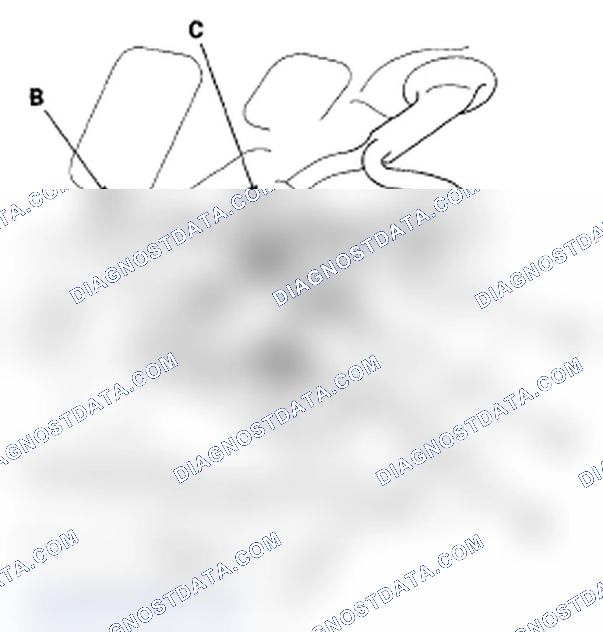 Scheme 142: FTP Sensor Replacement
