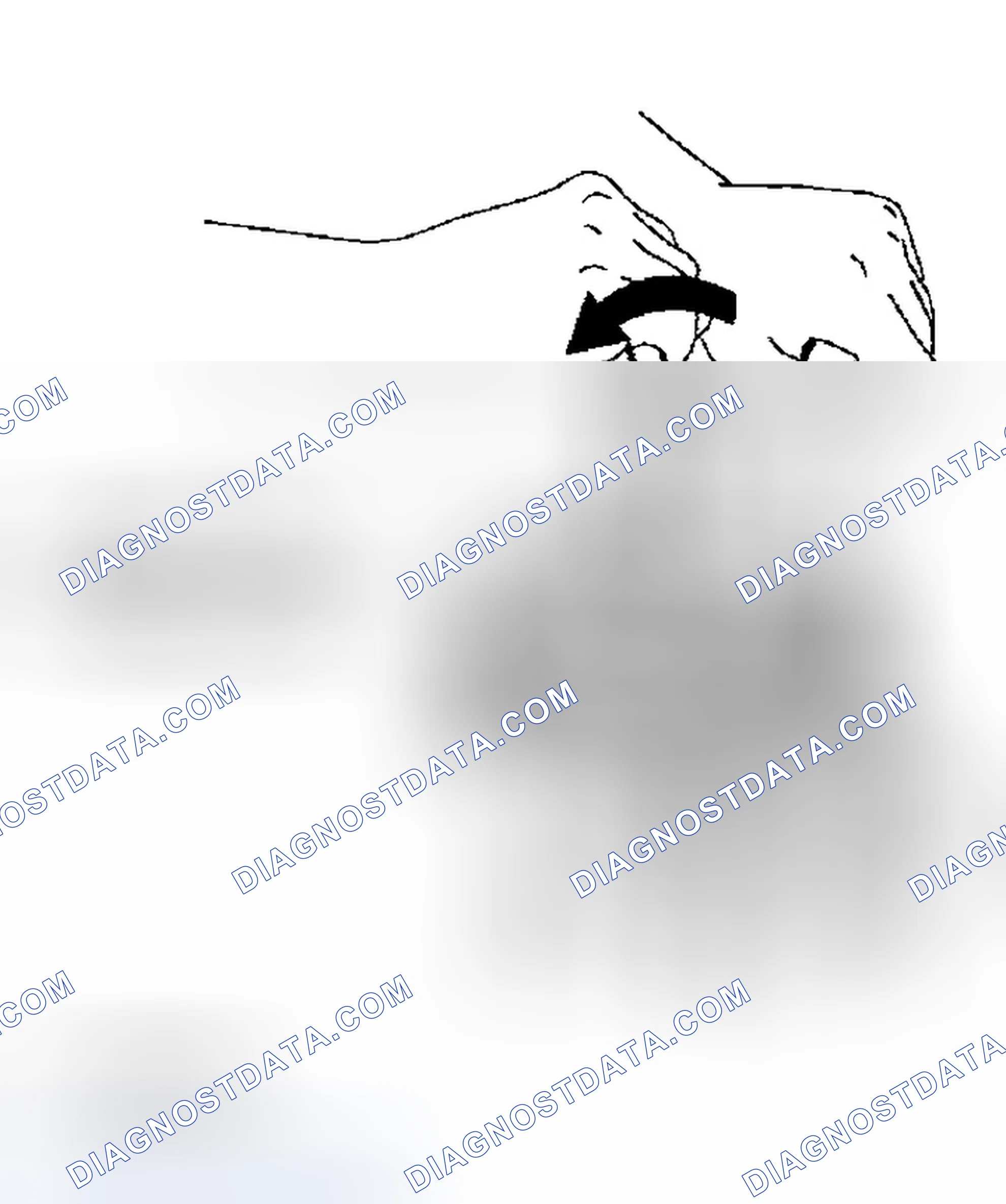 Scheme 107: REMOVAL