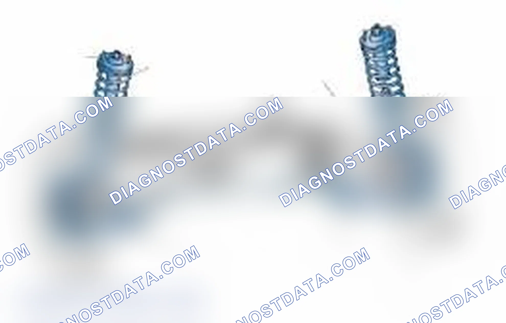 Scheme 25: Typical Front Suspension & Steering Components