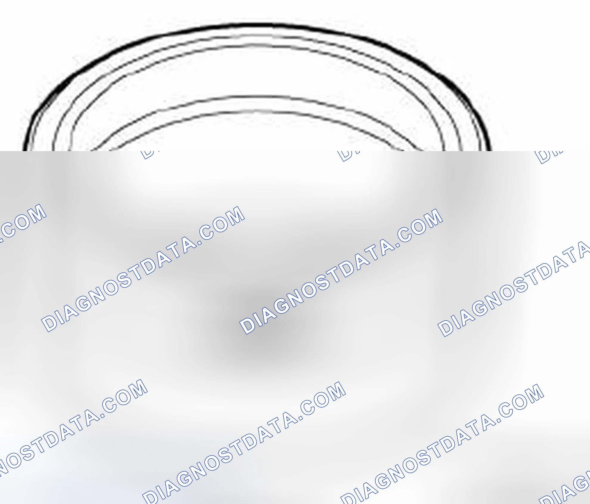 Scheme 402: 11 6 260 Mounting sleeves with case