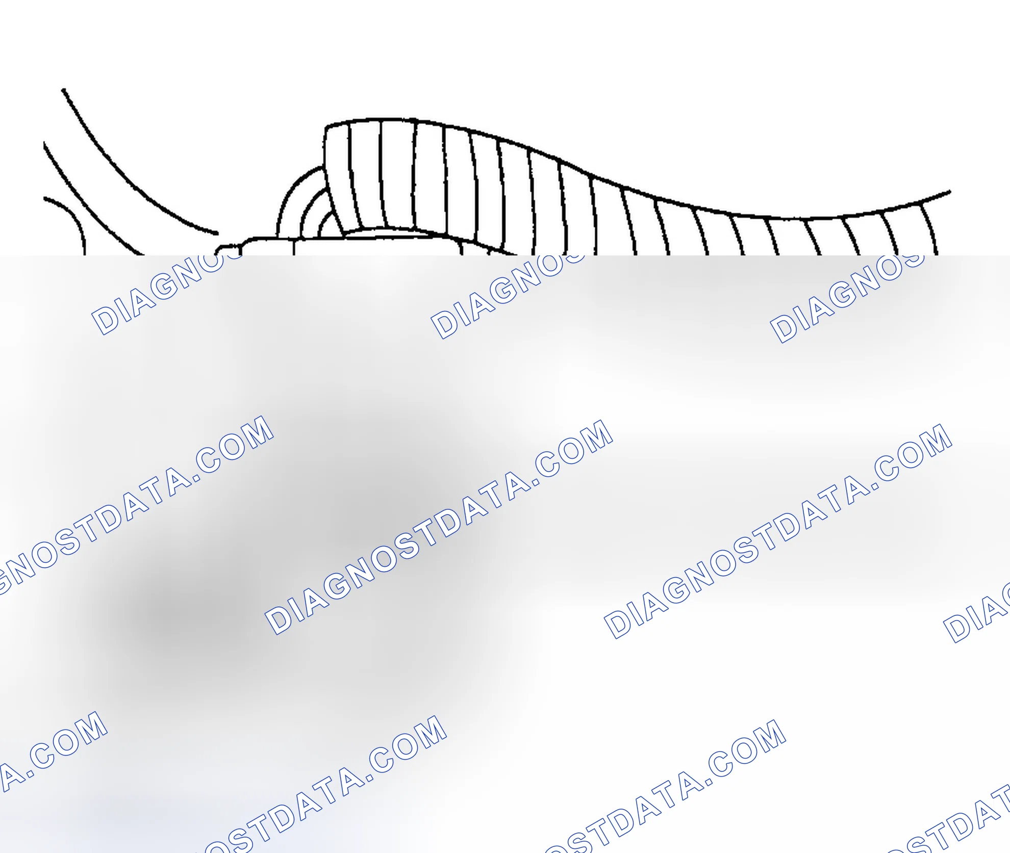 Scheme 6: Removal & Installation (B4000)