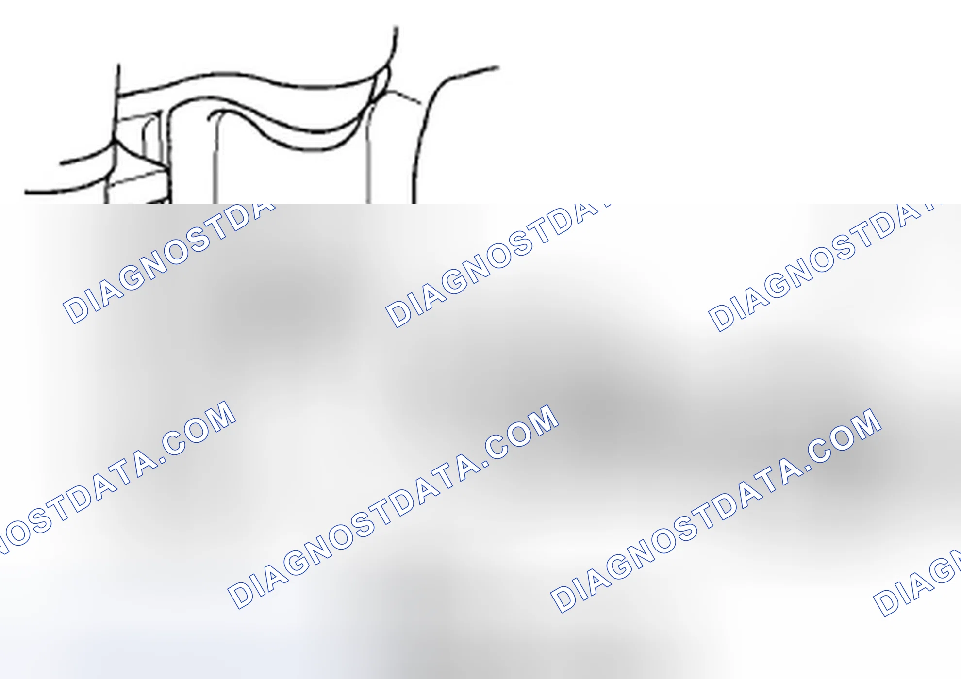 Scheme 880: Knock Sensor Replacement