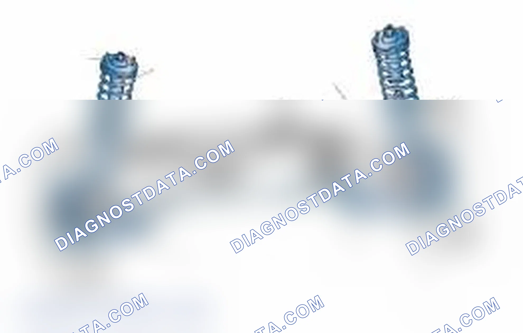 Scheme 25: Typical Front Suspension & Steering Components