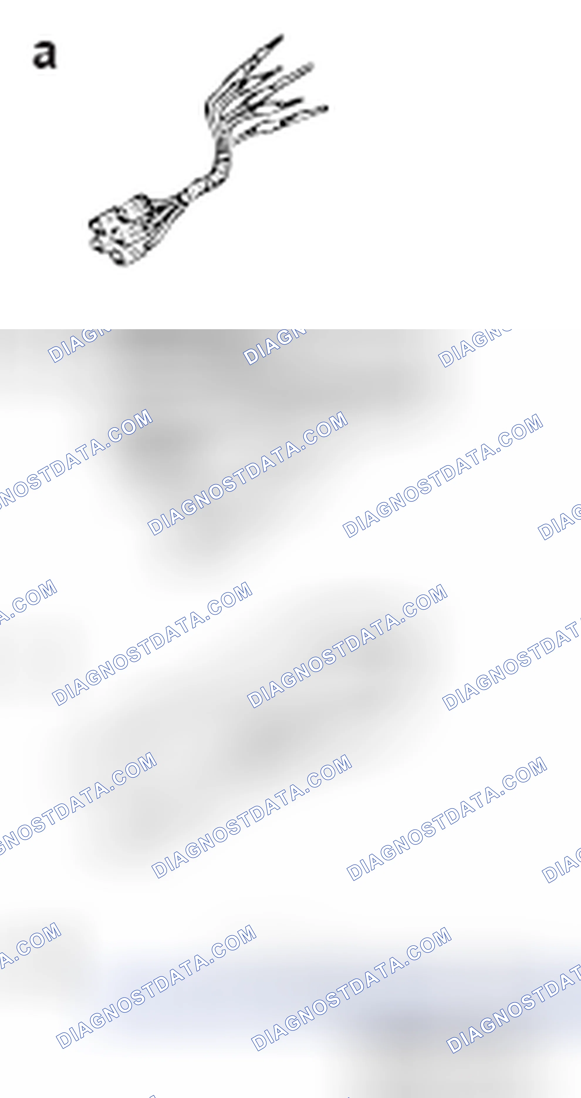 Scheme 18: SPECIAL TOOLS