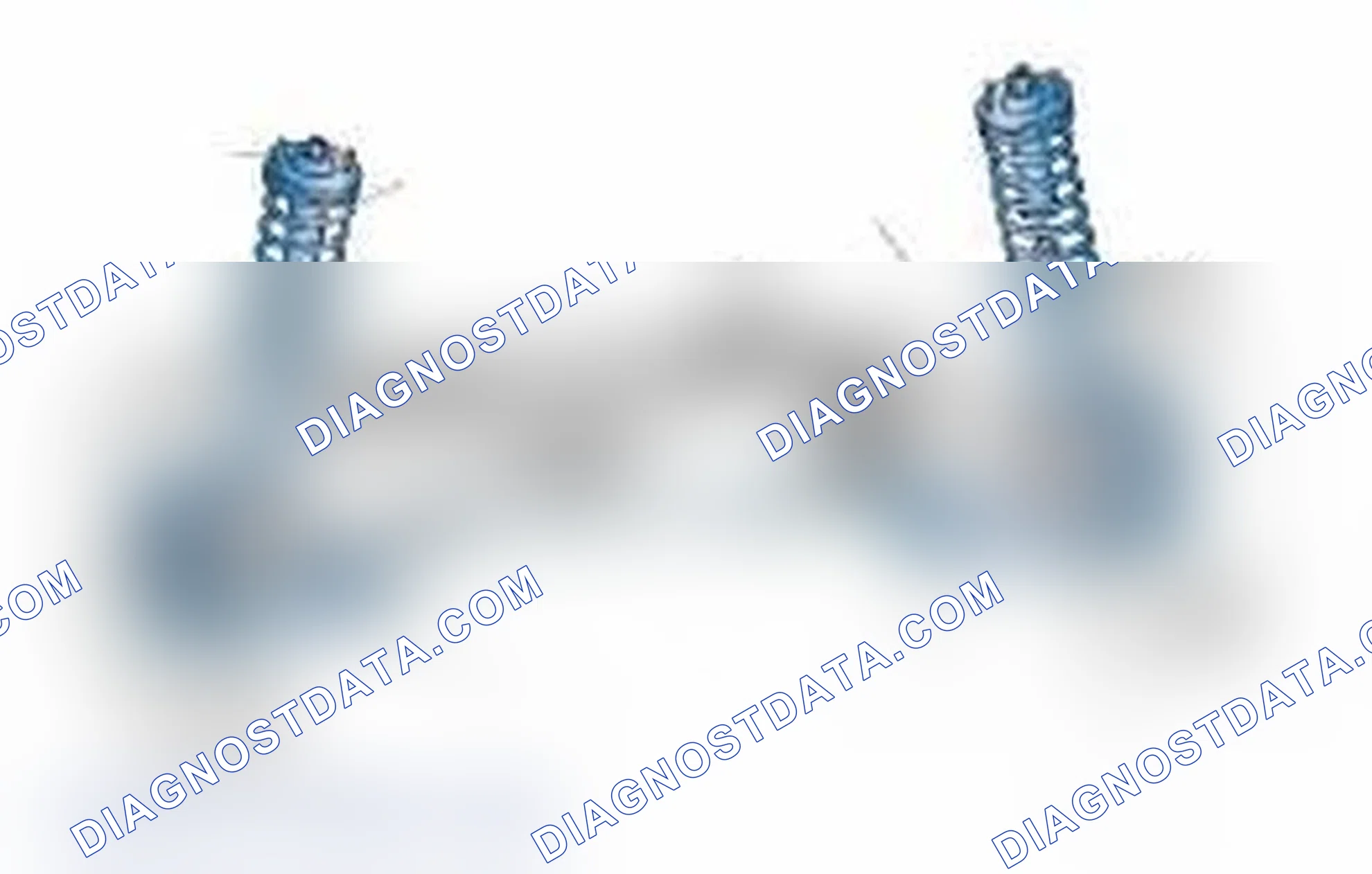Scheme 25: Typical Front Suspension & Steering Components
