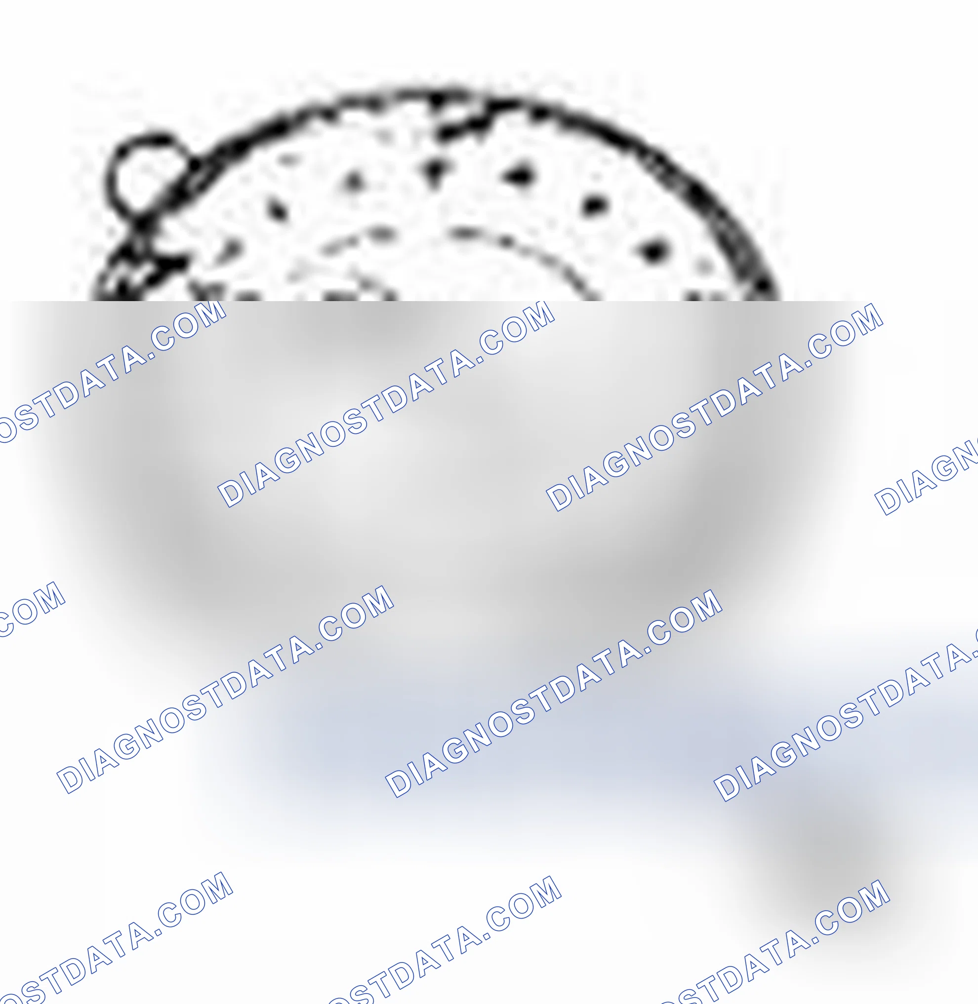Scheme 73: Special Tool