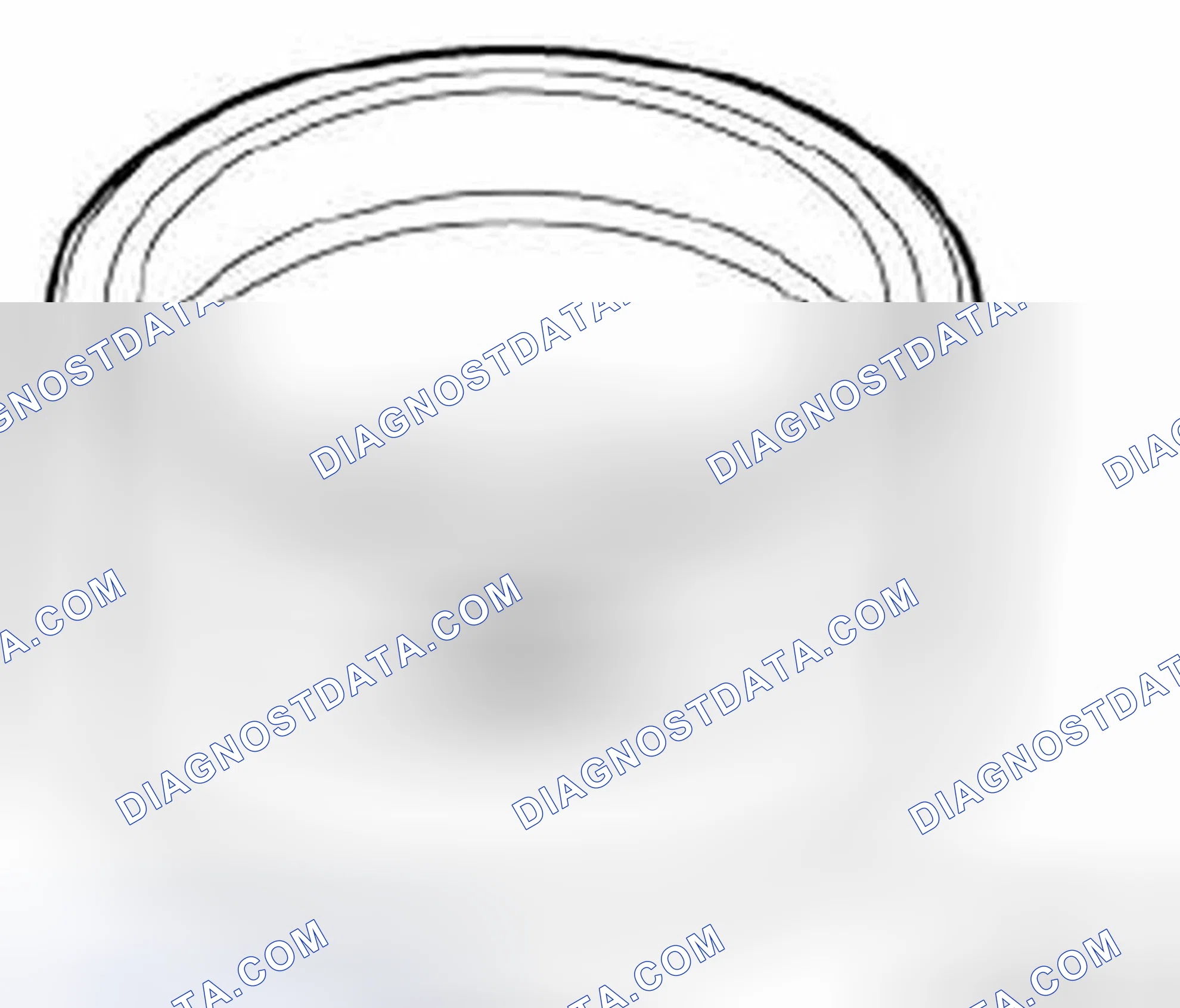 Scheme 285: 11 6 260 Mounting sleeves with case