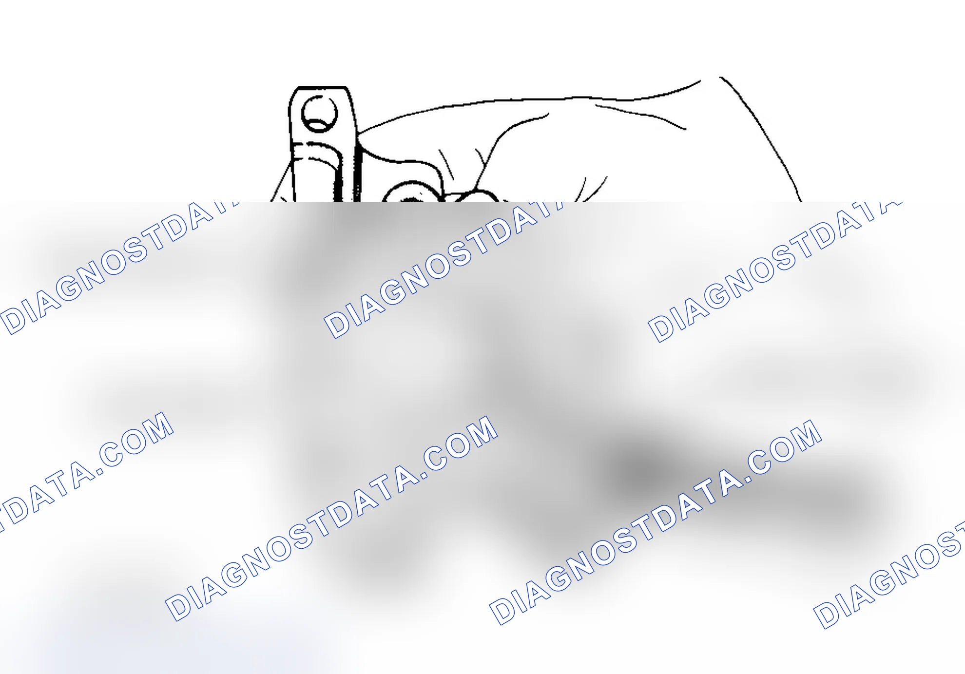 Scheme 33: Measuring Rotor Clearance