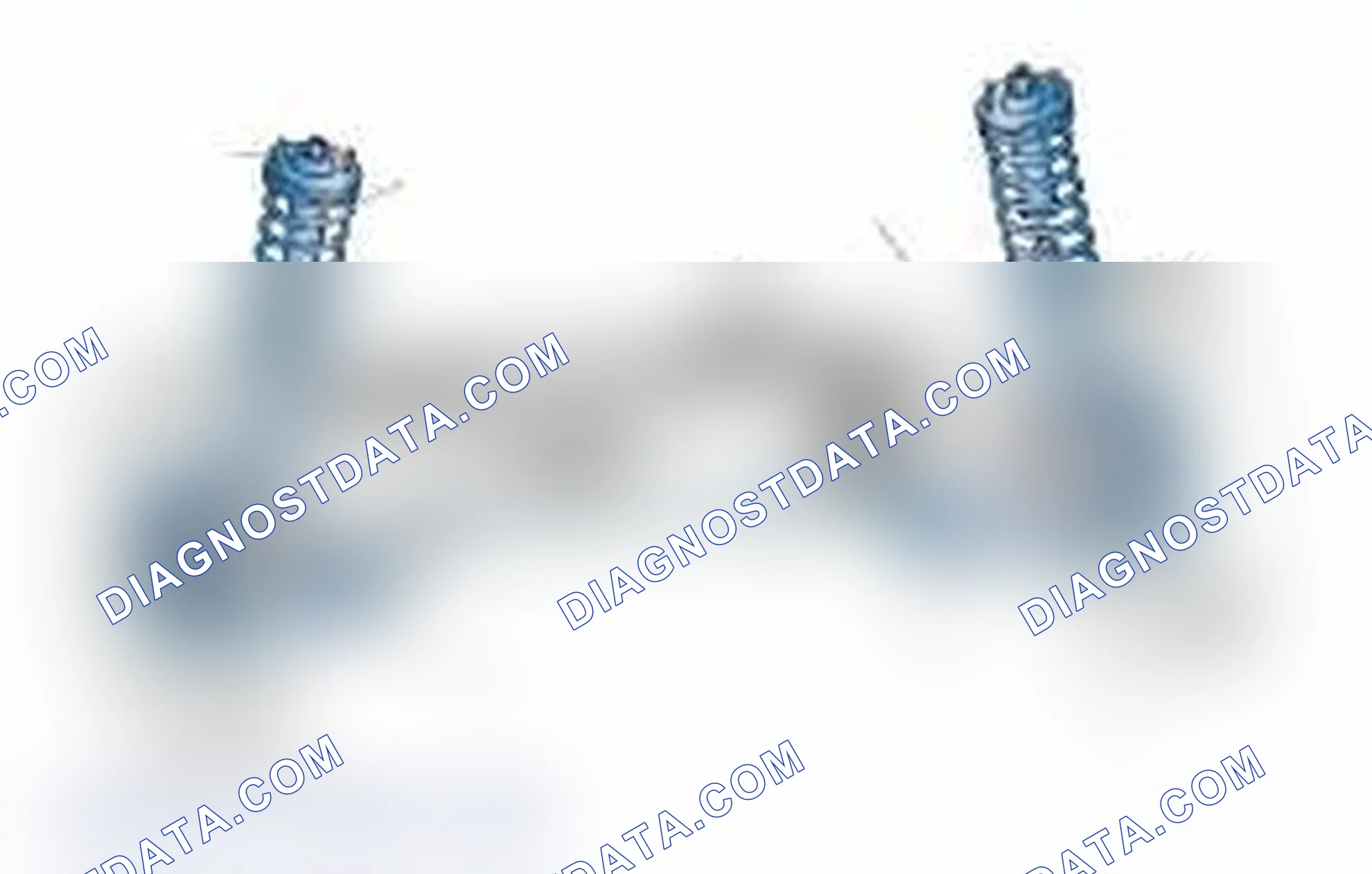 Scheme 25: Typical Front Suspension & Steering Components