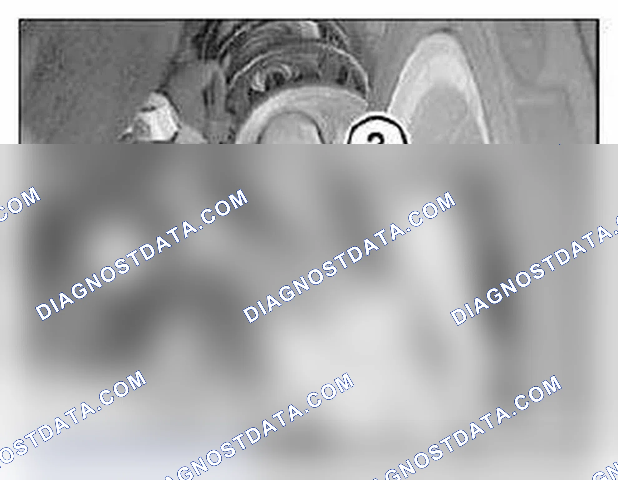 Scheme 56: 31 35 007 REMOVING AND INSTALLING/REPLACING HOLDER FOR LEFT OR RIGHT PUSH ROD/STABILIZER