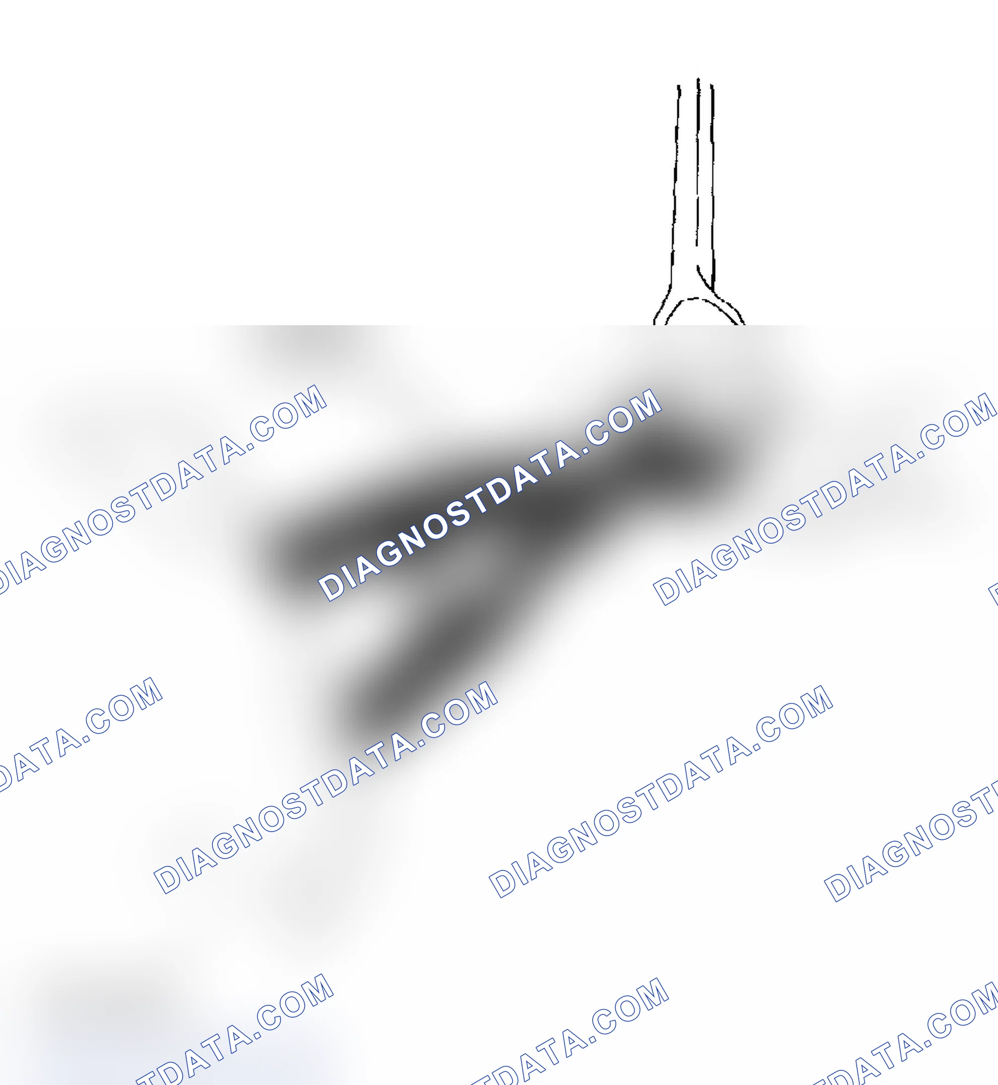 Scheme 23: Removal Procedure