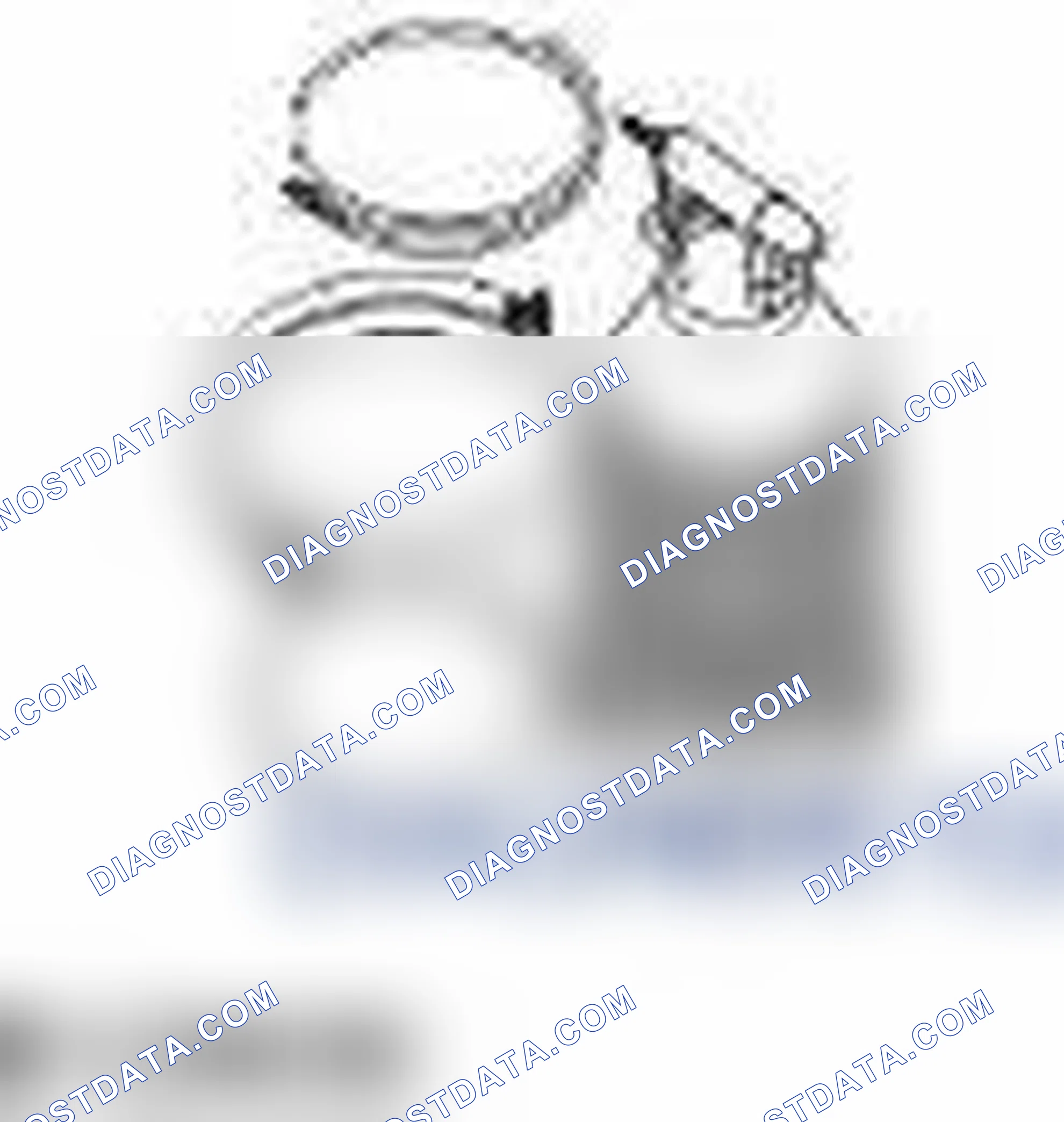 Scheme 277: ENGINE OIL VACUUM DRAINING AND FILLING